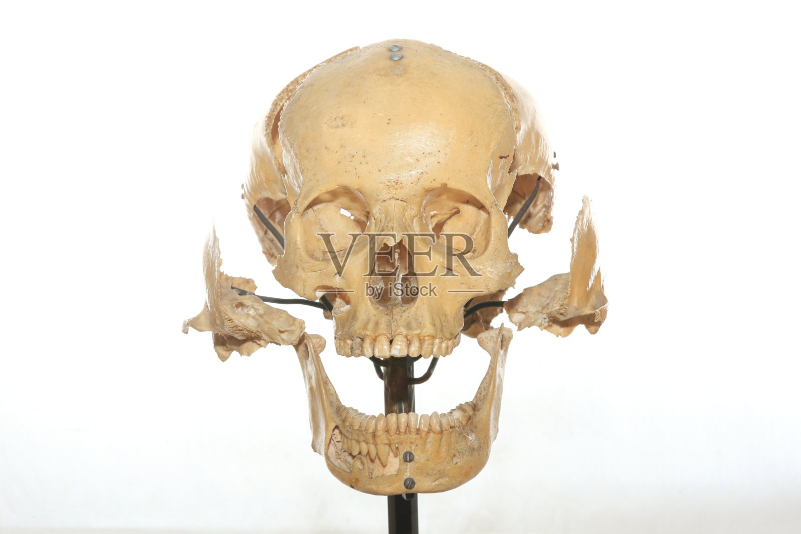 头部骨骼解剖医学图像照片摄影图片