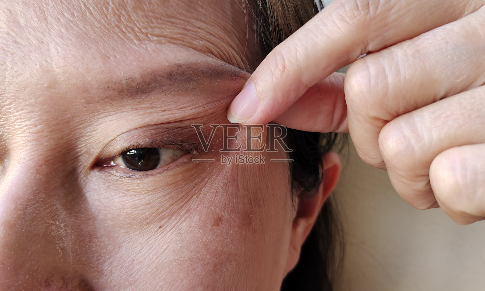挤压眼睑旁的松弛和瑕疵。照片摄影图片