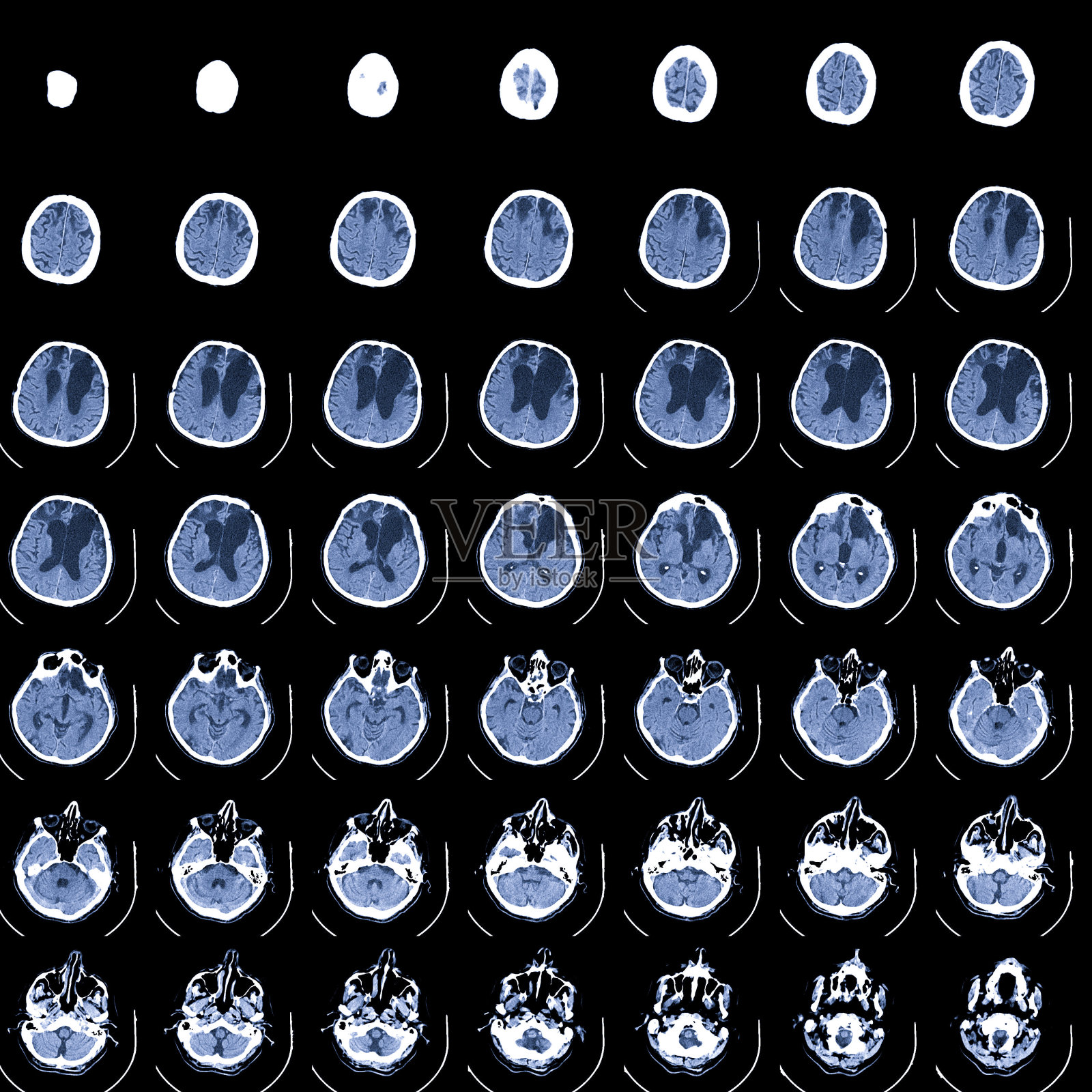 对大脑进行核磁共振扫描。磁共振成像扫描。医学、科学、教育CT背景照片摄影图片