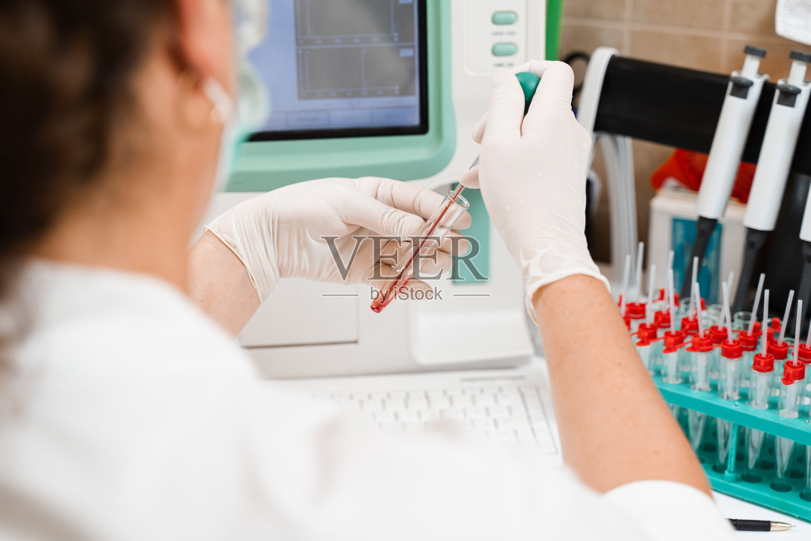 实验室助理在实验室进行血液分析仪和血液学分析。实验室的医疗设备血液的生化和血液学分析。照片摄影图片