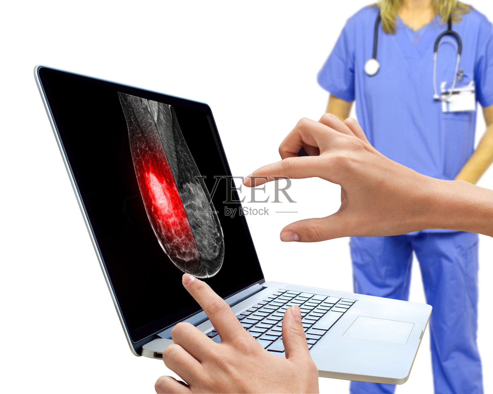 医生使用数字平板与x射线数字乳房x光片隔离在白色背景。照片摄影图片