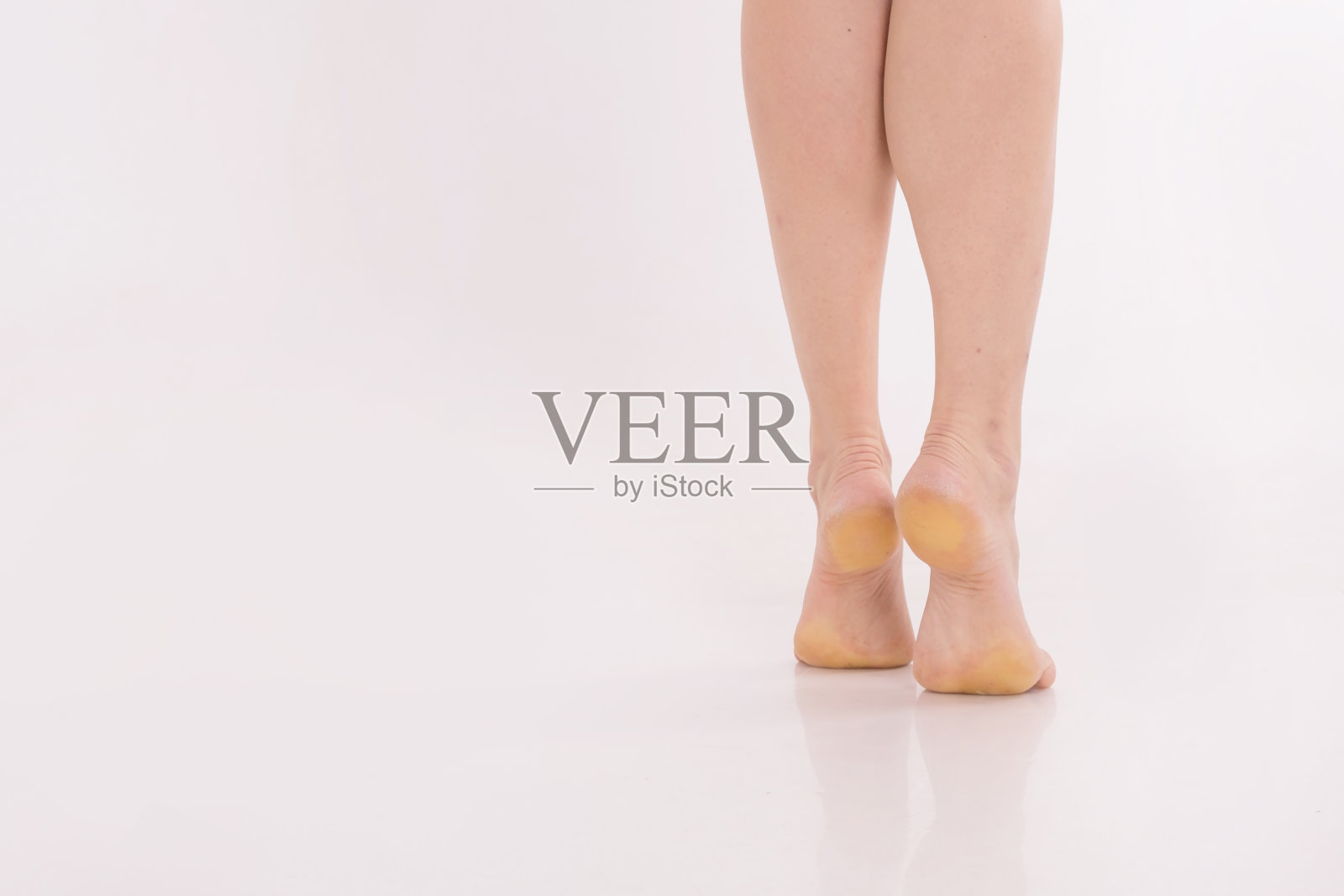 白色背景上漂亮的女人脚。脚的纯白色皮肤,用剃刀刮腿,静脉曲张,鸡眼,疣,腿霜。照片摄影图片