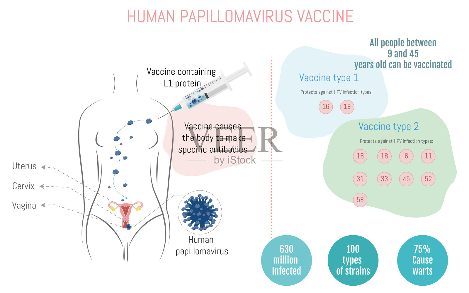 人类乳头瘤病毒疫苗如何起作用的信息图插画图片素材