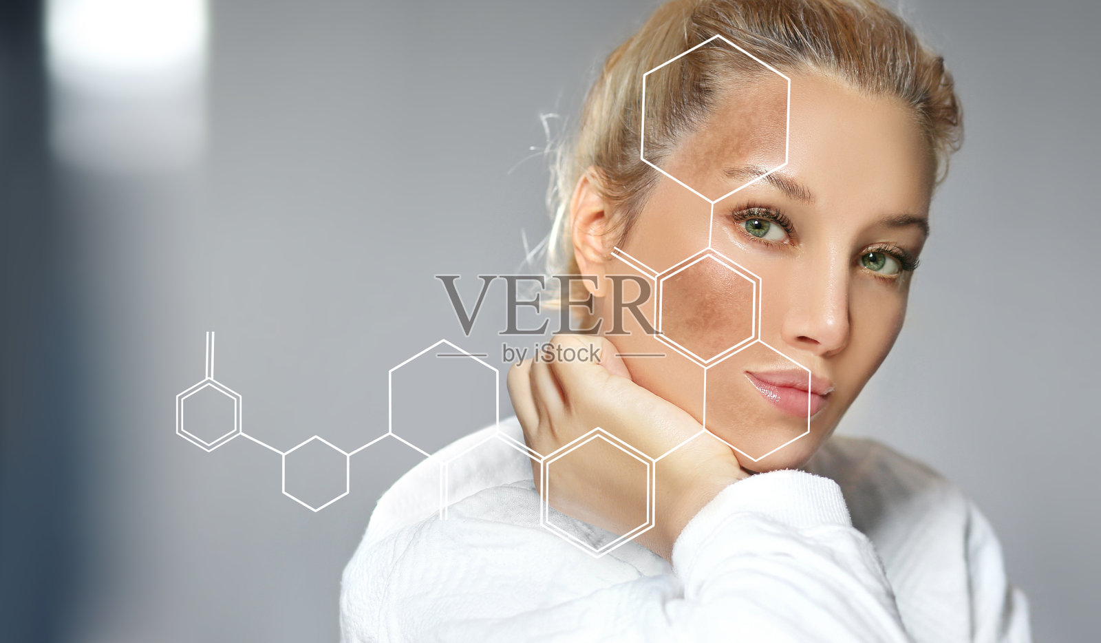 黑斑,雀斑,色素沉着(黄褐斑或黄褐斑),概念-皮肤提亮,皮肤美白,果酸,AHA,皮肤提亮照片摄影图片