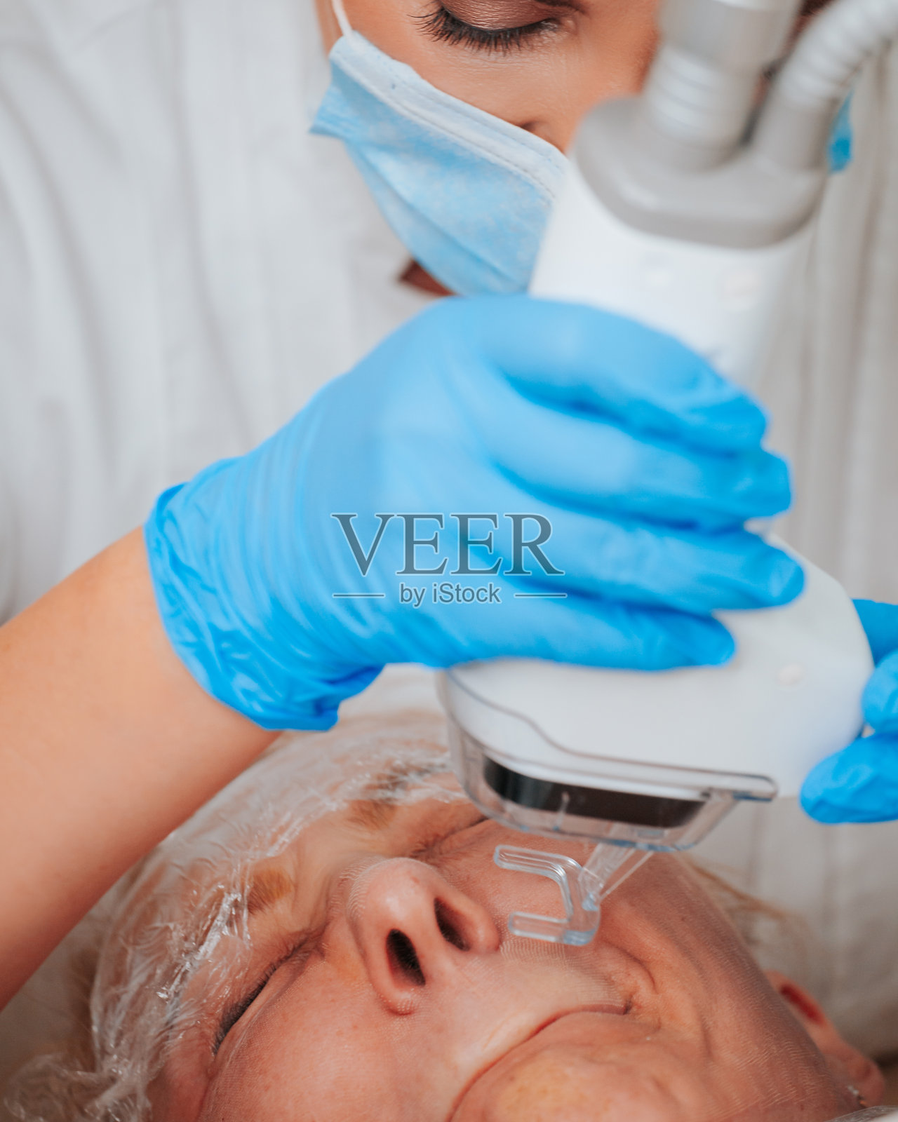 局部激光表皮表面修复照片摄影图片