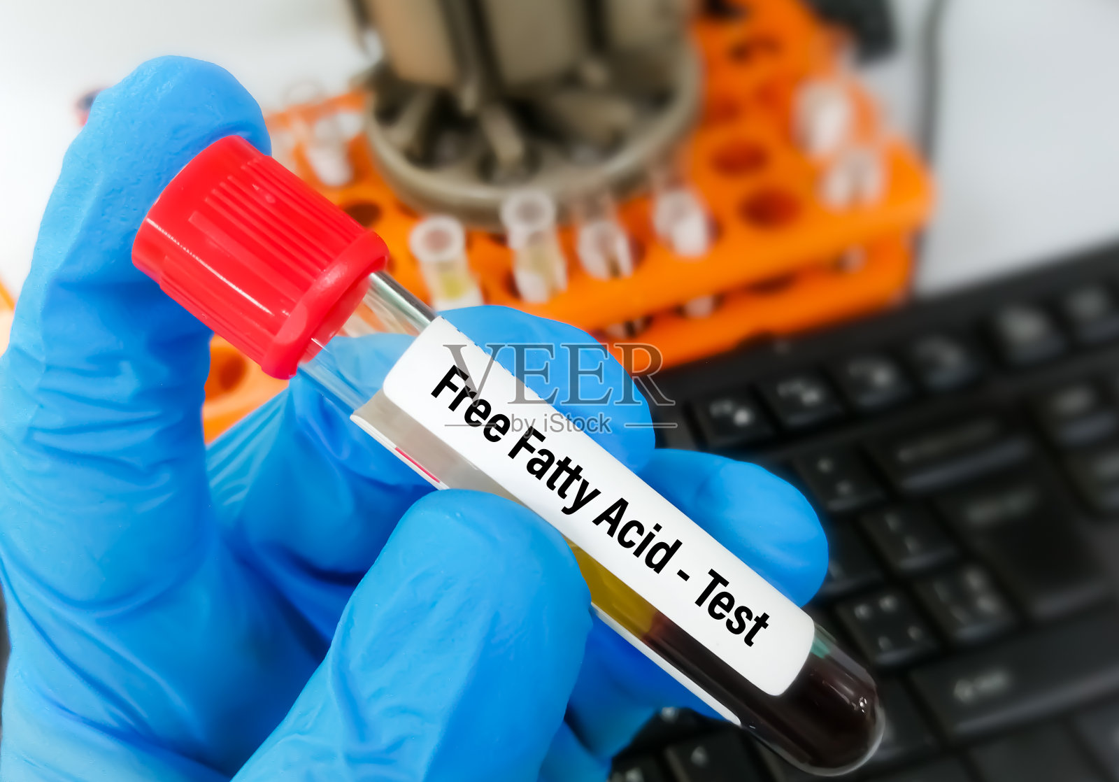 血液样本进行游离脂肪酸测试。照片摄影图片