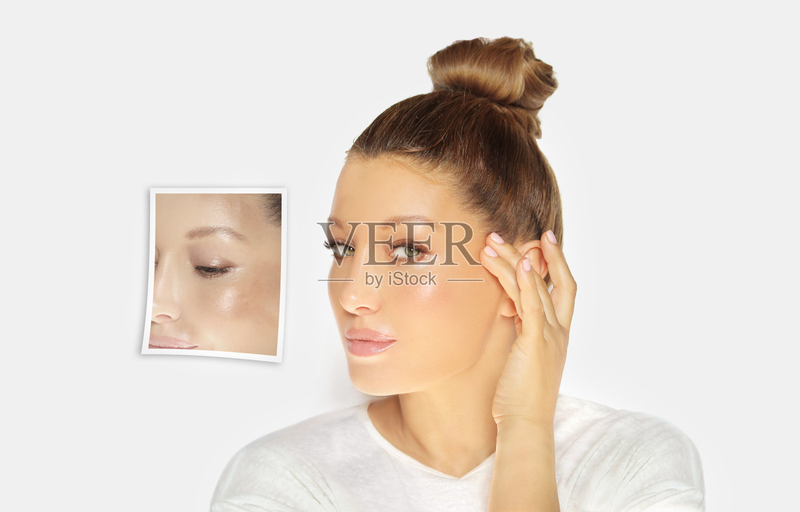 黑斑,雀斑,色素沉着(黄褐斑或黄褐斑),概念-皮肤提亮,皮肤美白,果酸,AHA,皮肤提亮照片摄影图片