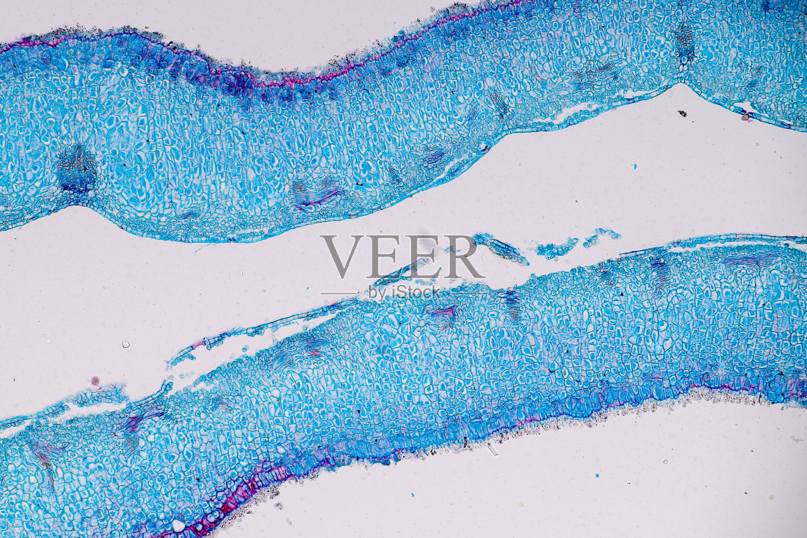 带有孢子(霉菌)的宿主细胞在木材内部。照片摄影图片
