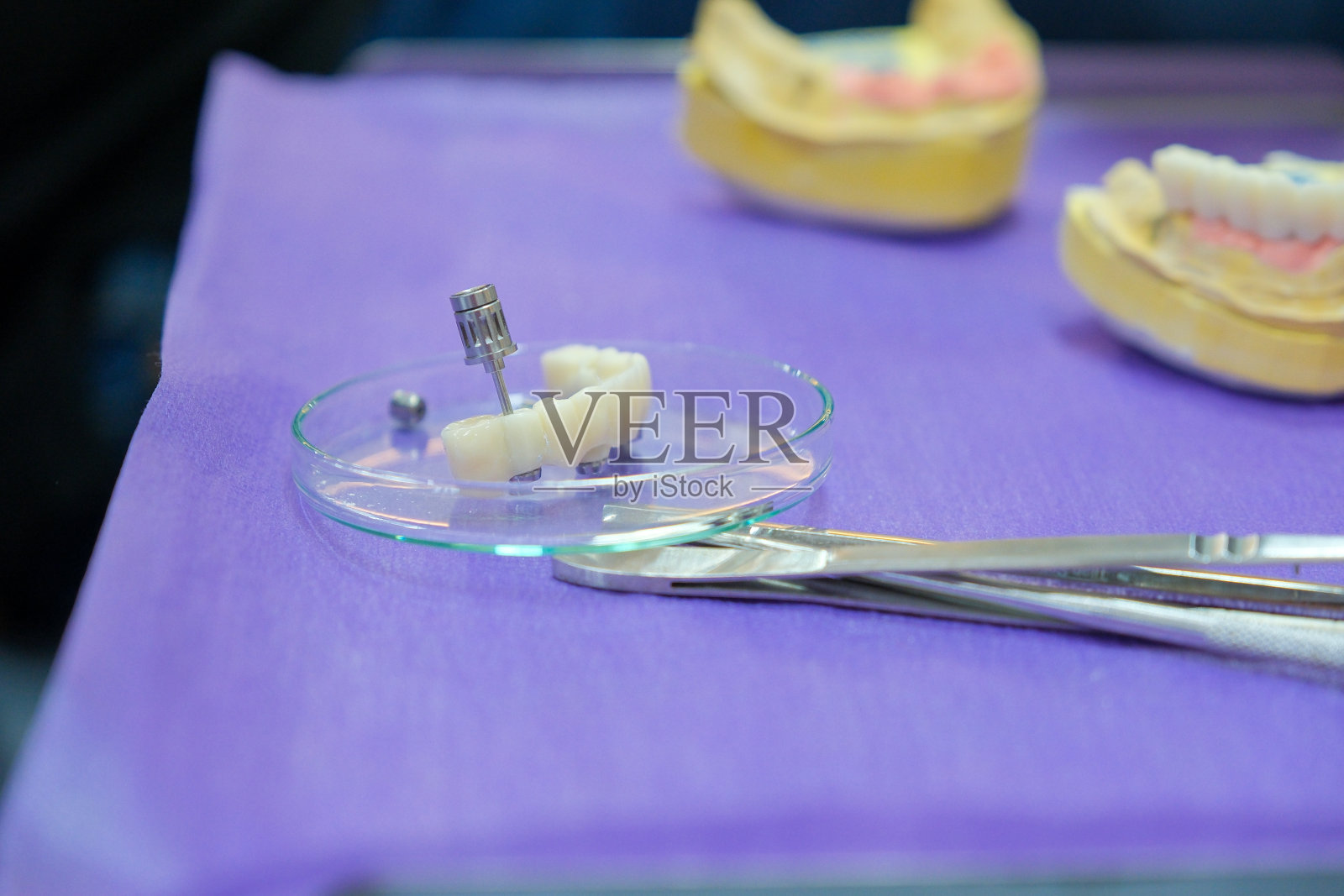 全新的烤瓷贴面假牙和种植牙照片摄影图片