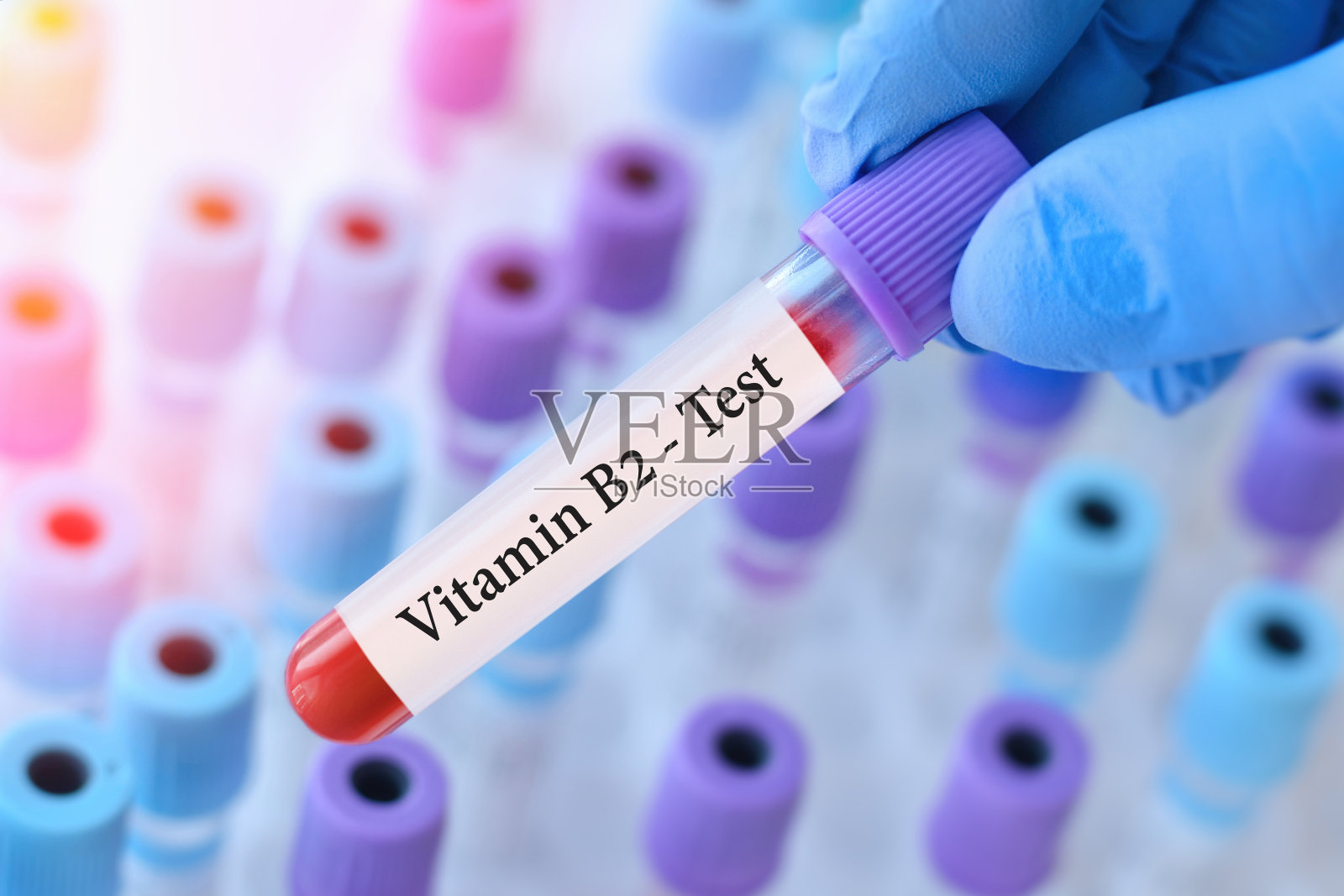 医生拿着测试血液样本试管进行维生素B2测试,背景是医学试管进行分析照片摄影图片