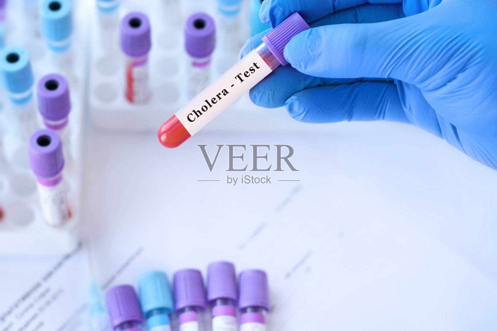 医生拿着一根检测霍乱的血样管,背景是医用试管与分析。照片摄影图片