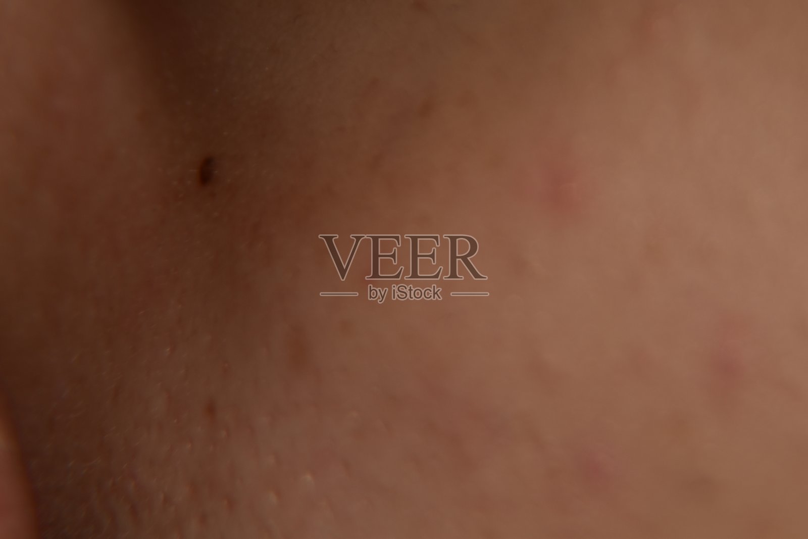 白种人皮肤的近照照片摄影图片