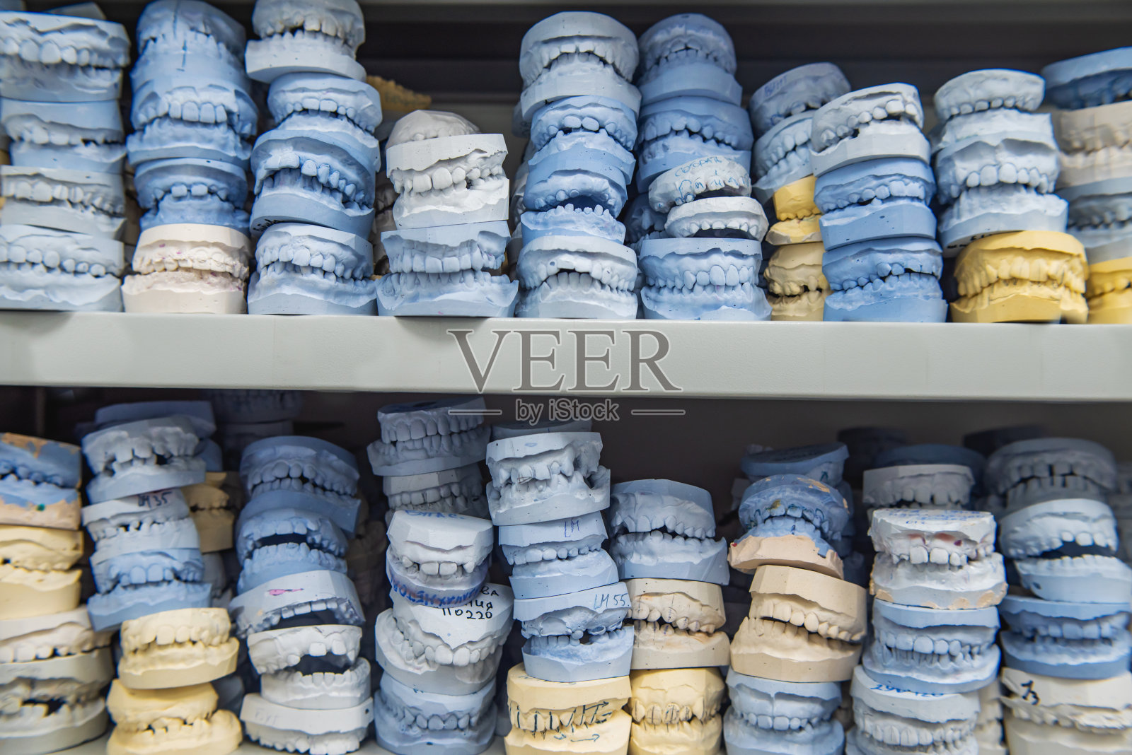 在一个正畸诊所的人类颌骨石膏模型仓库。矫正器的控制和诊断牙模。照片摄影图片