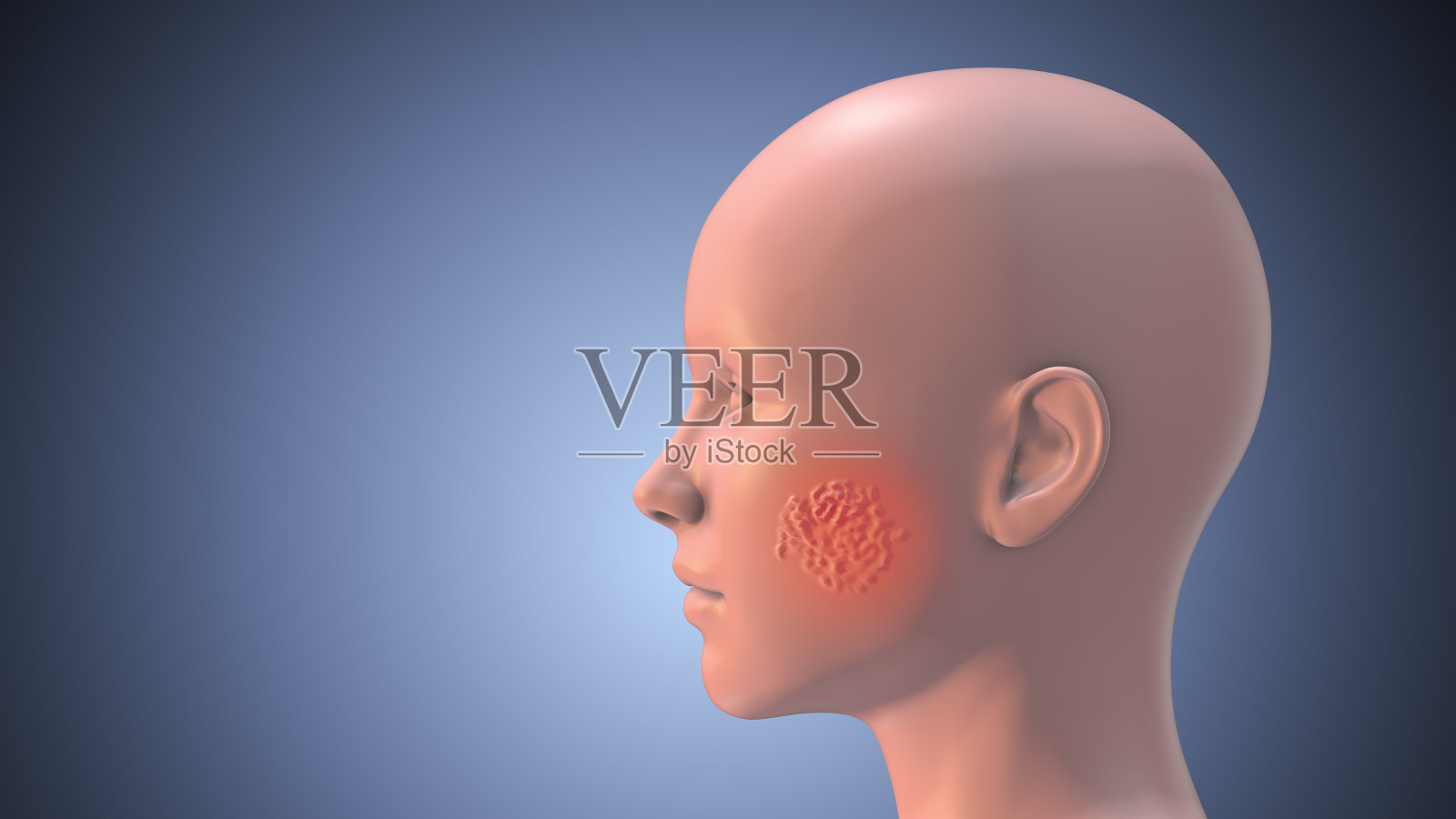长着蜘蛛血管的人脸照片摄影图片