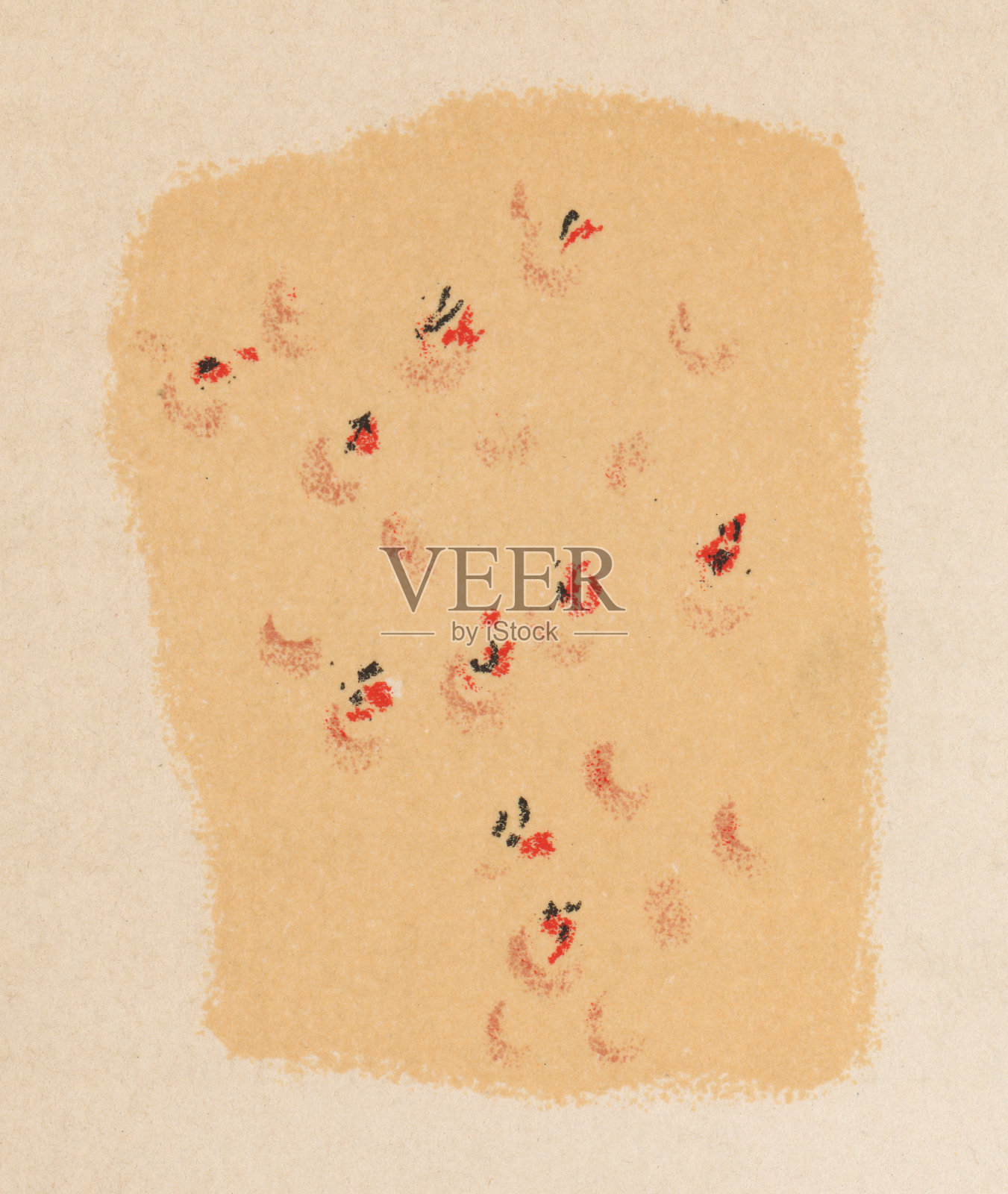 人体皮肤与结节性痒疹的医学插图- 19世纪插画图片素材