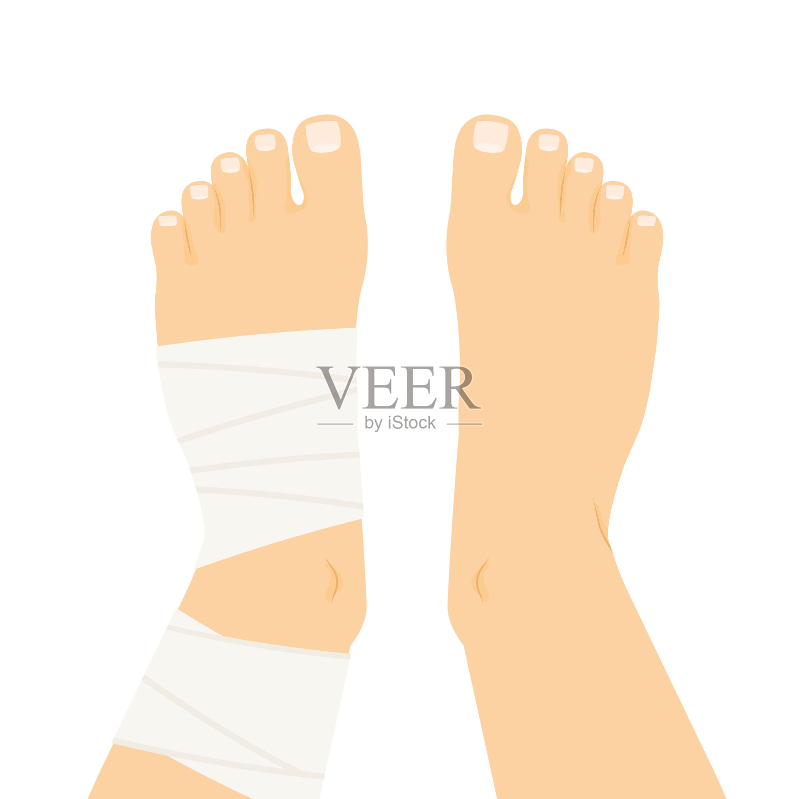 包扎在扭伤的脚踝上的压缩绷带插画图片素材