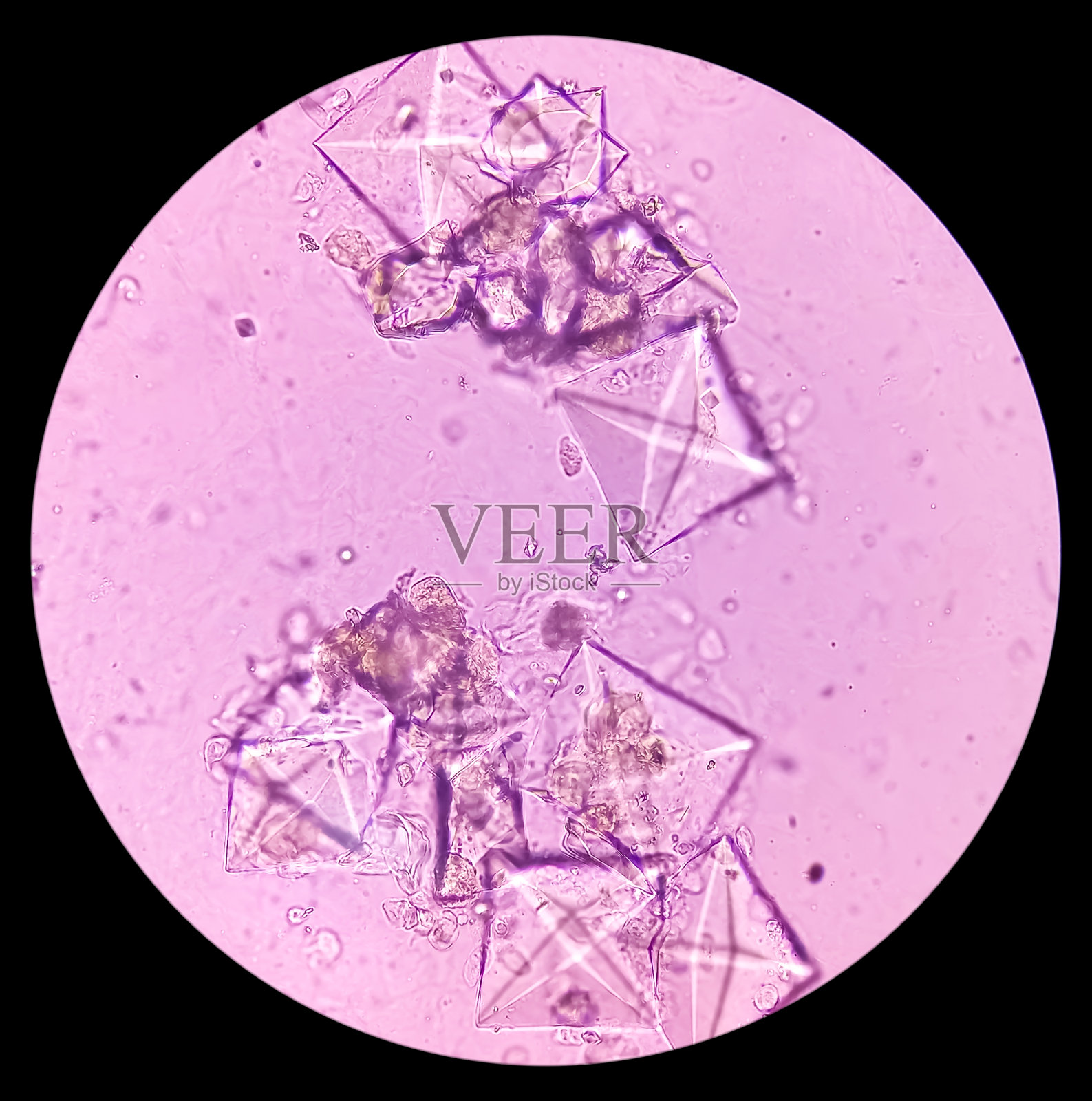 显微镜图像显示尿液沉积物中有许多草酸钙晶体,这是肾结石最常见的原因。照片摄影图片