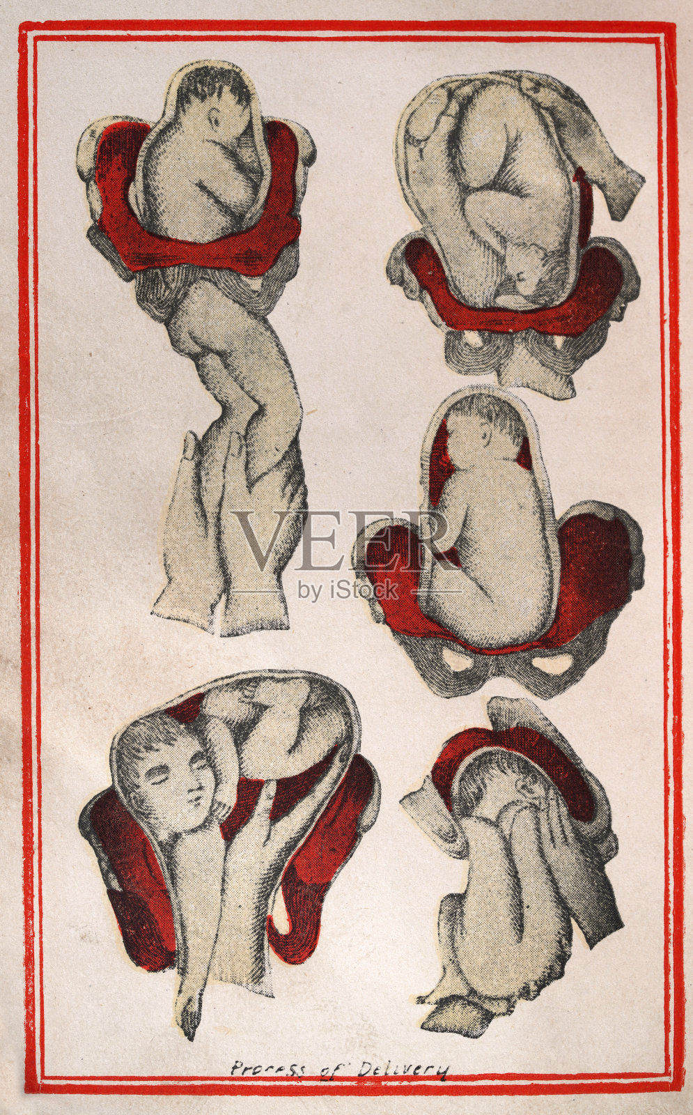 维多利亚时代的医学图表,分娩,分娩过程,子宫,怀孕,医学史,出自亚里士多德的杰作插画图片素材