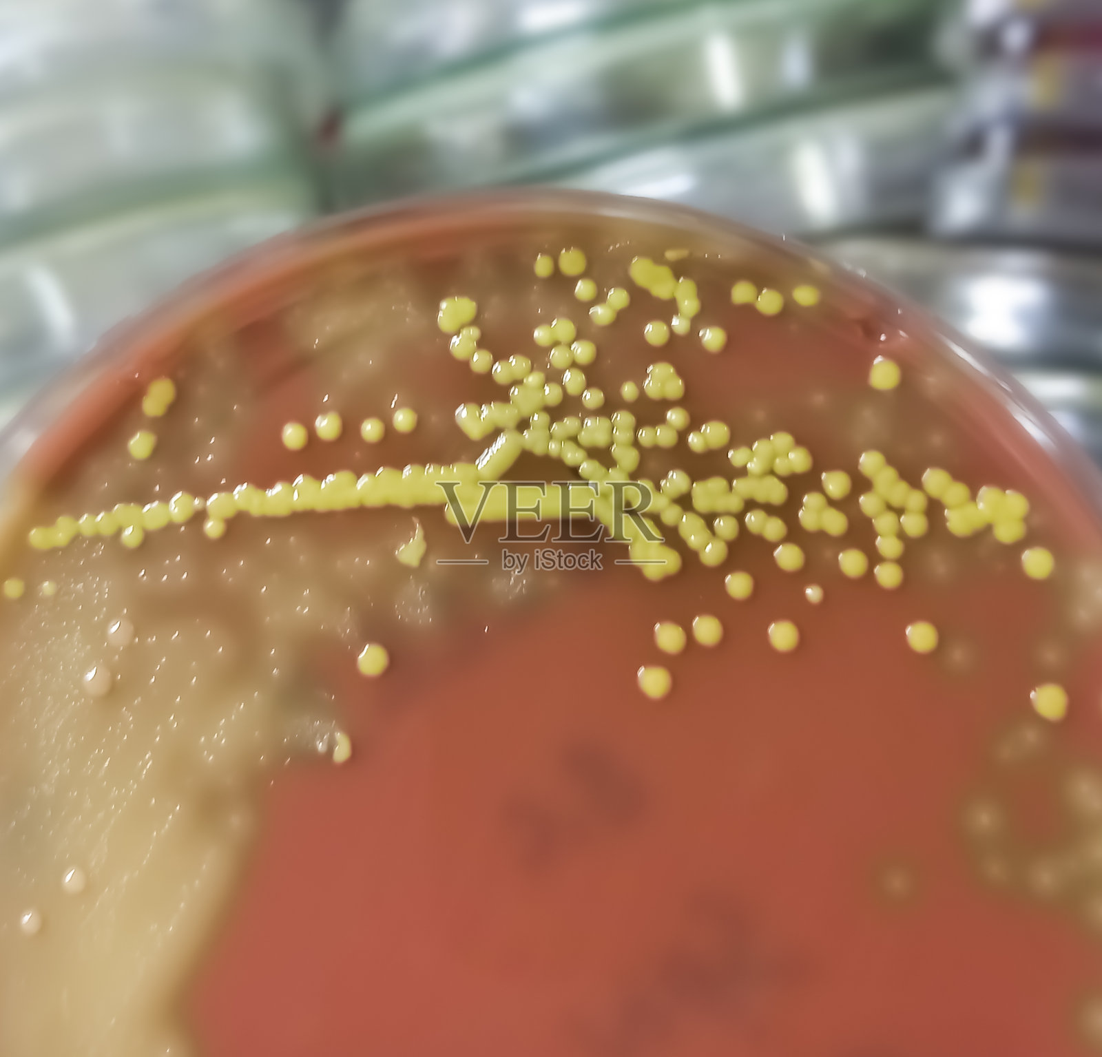 金黄色菌落在巧克力琼脂培养基上,金黄色葡萄球菌生长,革兰氏阳性菌在医学微生物实验室。金色葡萄球菌。照片摄影图片