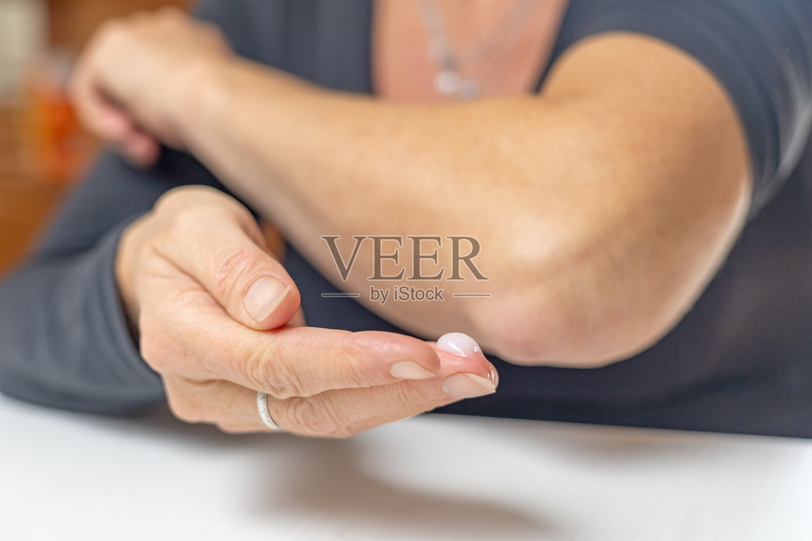 一位女士准备在她的手肘上涂抹治疗药膏。照片摄影图片