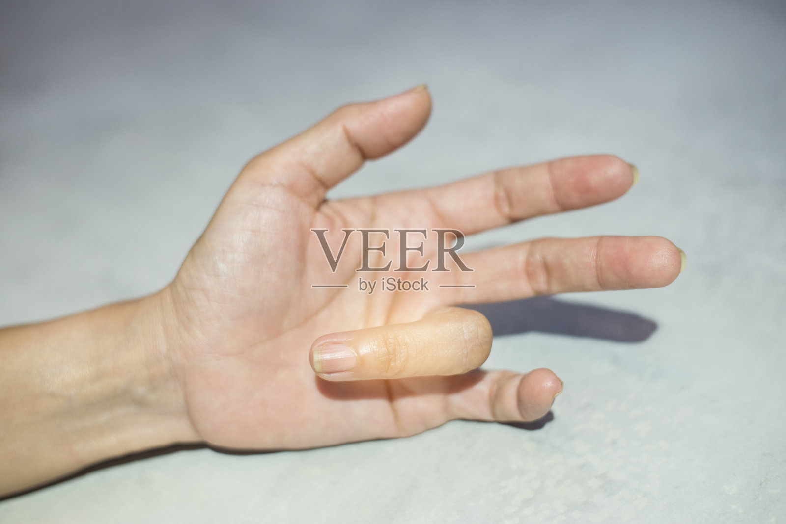 肌肉和神经系统:身体有运动障碍的手指照片摄影图片