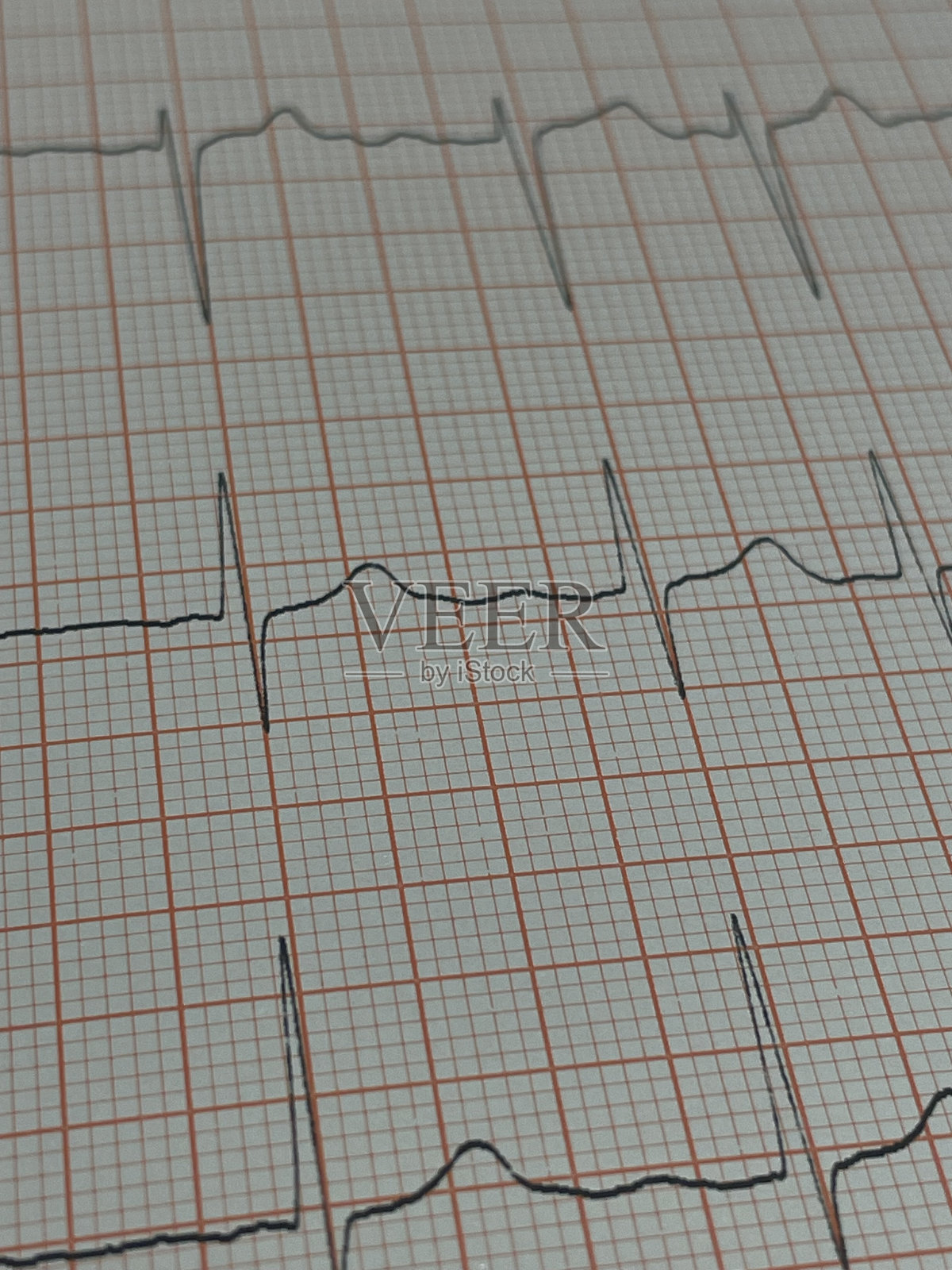心脏科门诊照片摄影图片