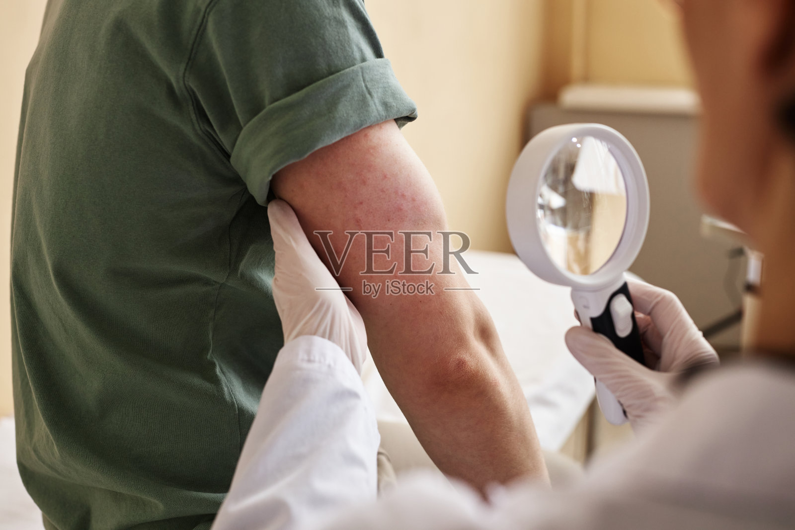 医生用放大镜检查皮肤的特写照片摄影图片