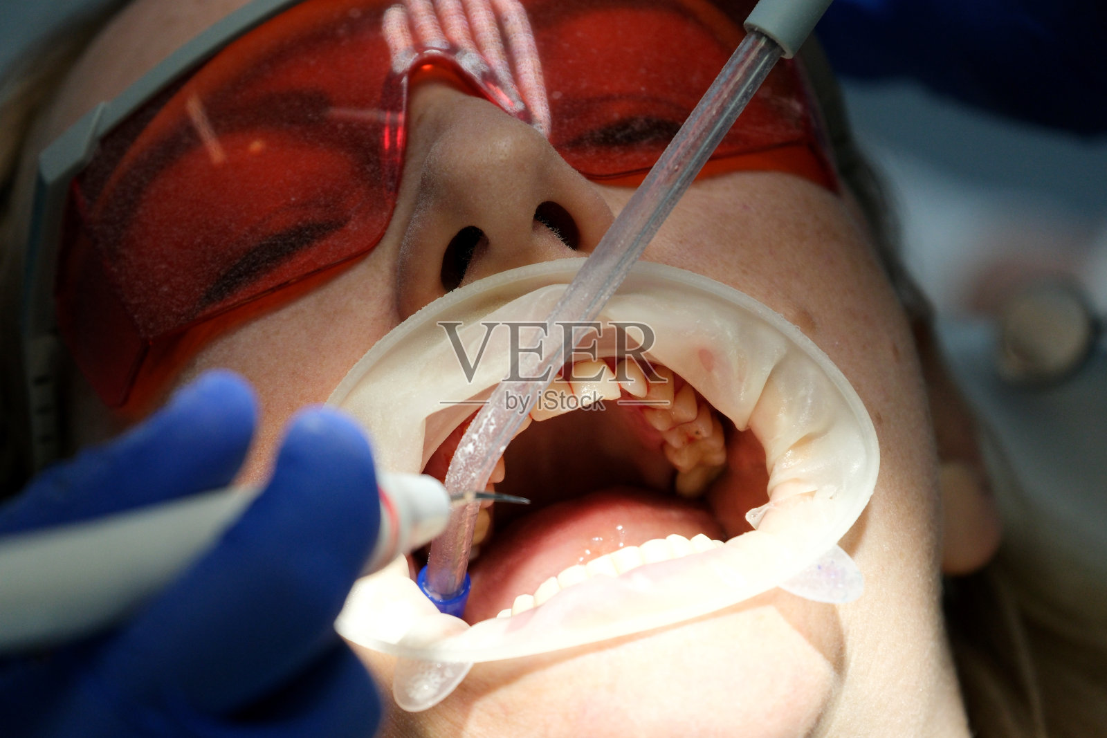 医疗保健,牙科和快乐的女患者与正畸医生进行口腔卫生,健康和清洁照片摄影图片