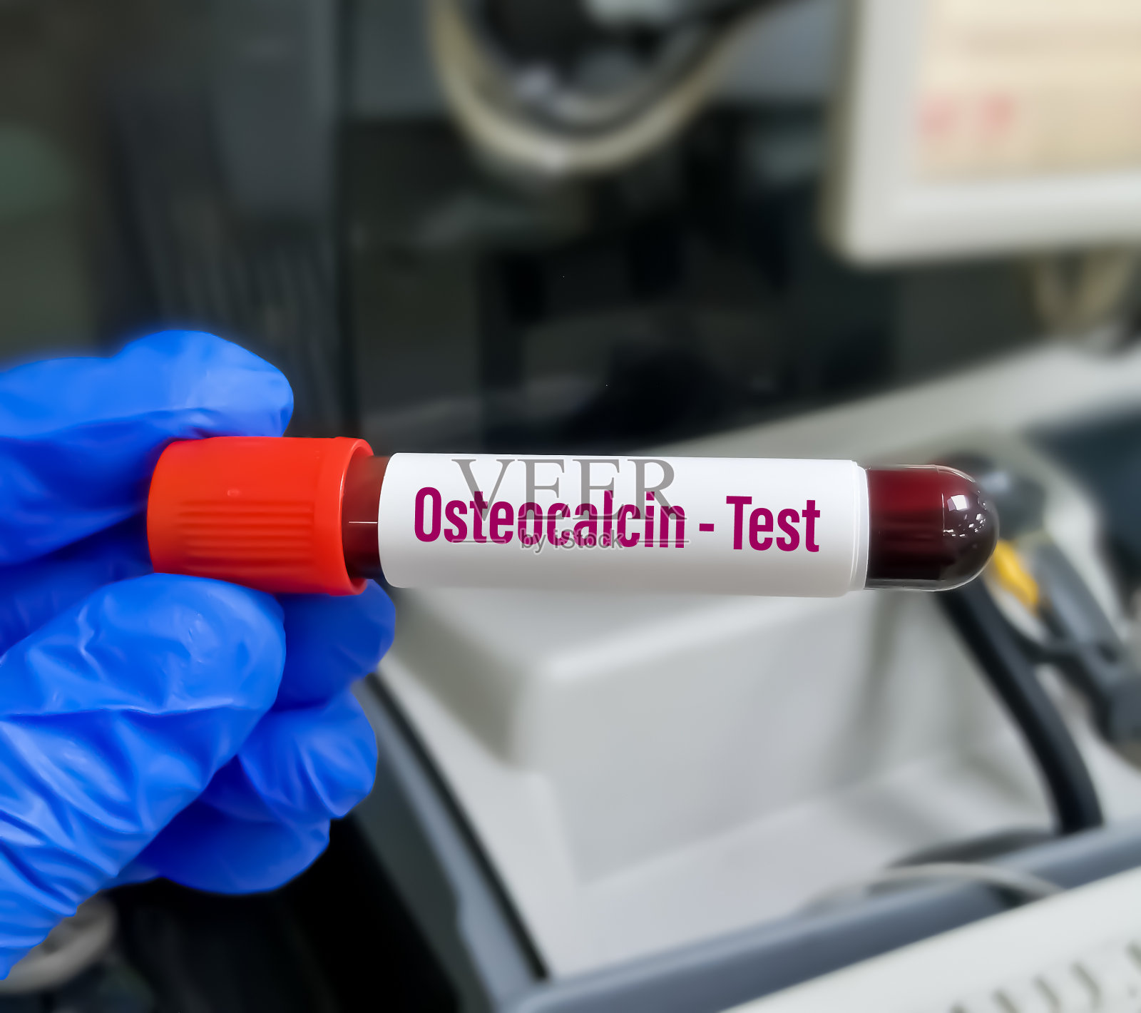 技师拿着血液样本进行骨钙素测试。骨标记照片摄影图片