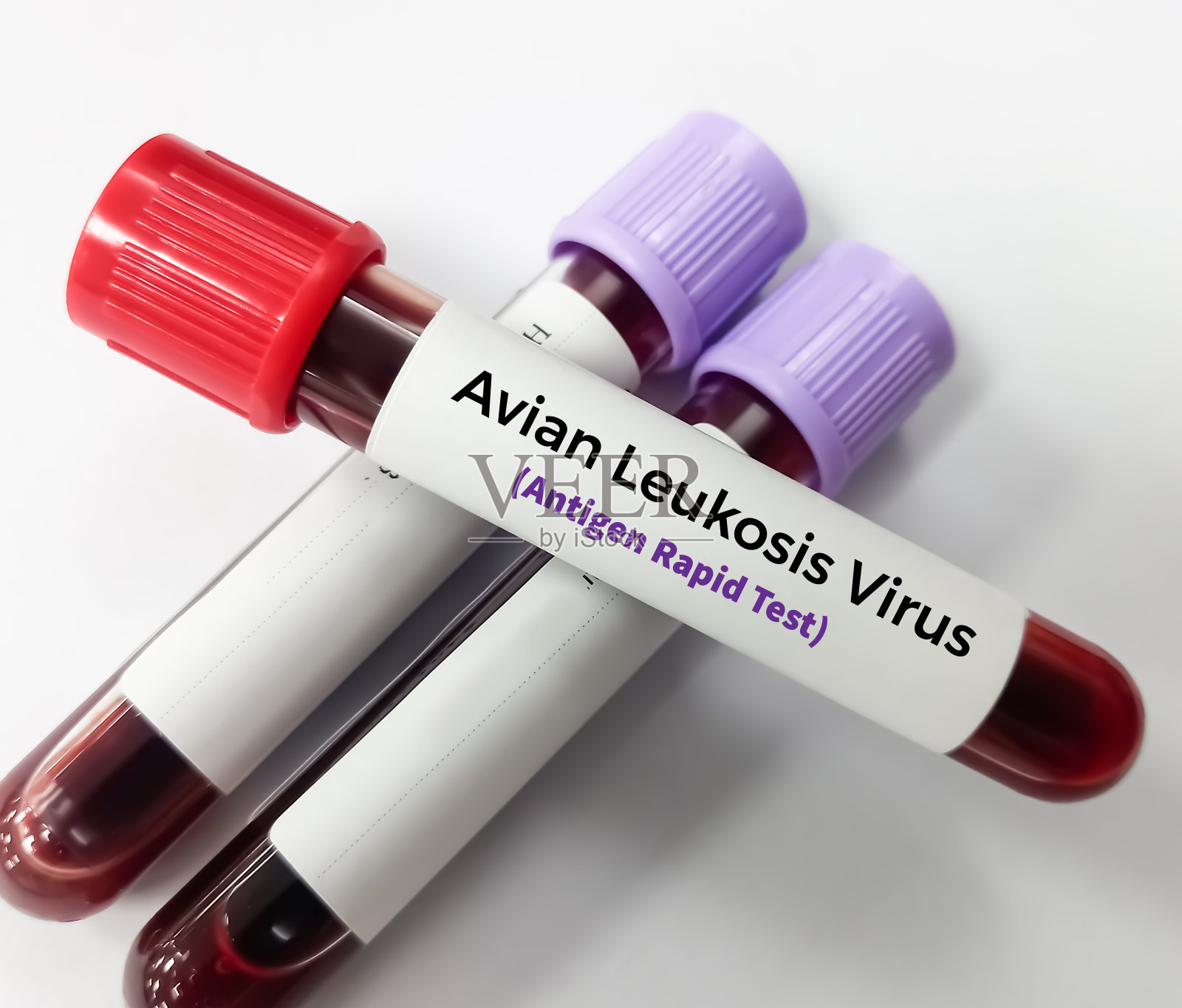 血样进行禽白血病病毒(ALV)抗体检测、RIF、COFAL、ALV抗体检测,以诊断检测禽白血病病毒p27抗原。照片摄影图片
