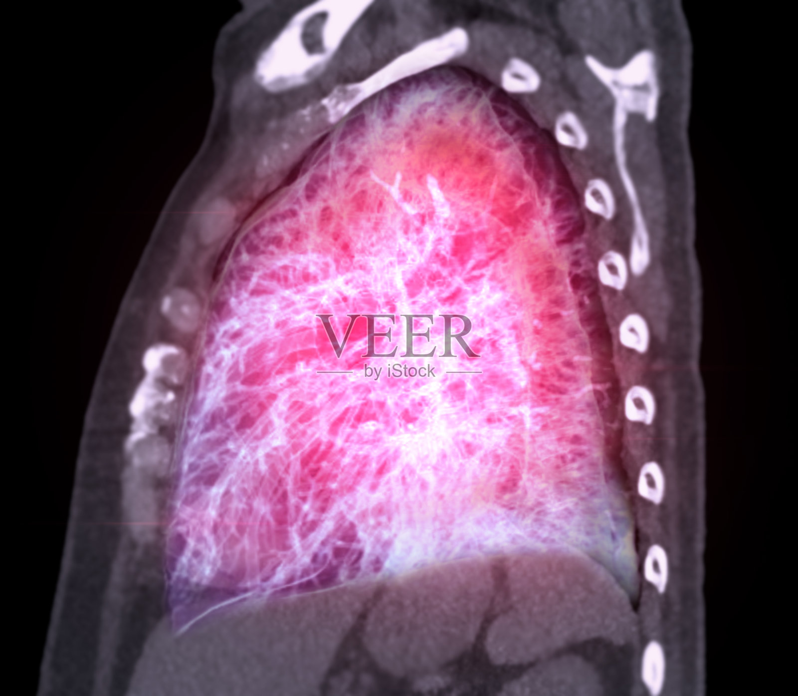 胸部或肺部CT三维渲染图显示呼吸系统气管和肺。照片摄影图片