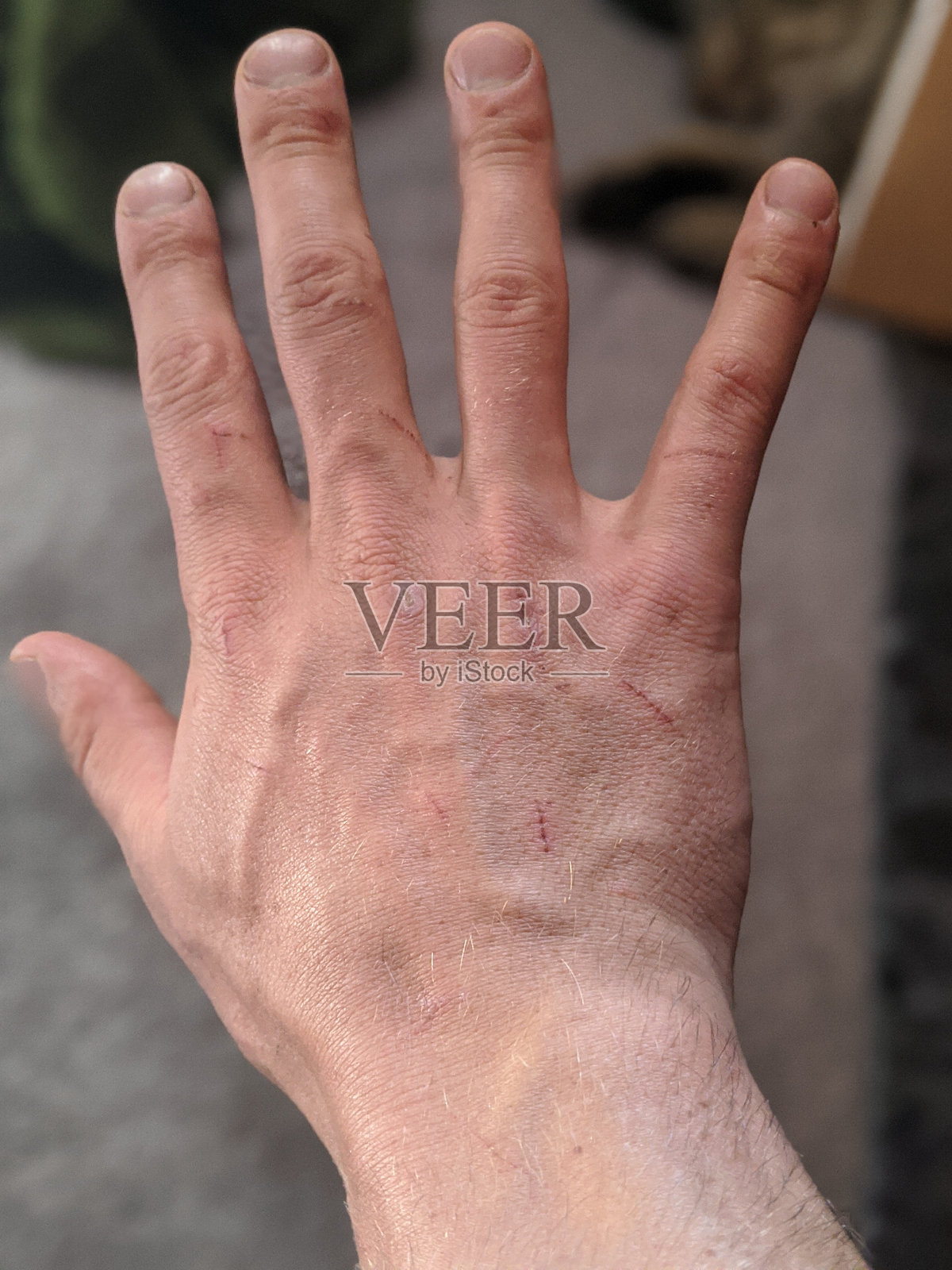 一个有抓痕的男人的手照片摄影图片
