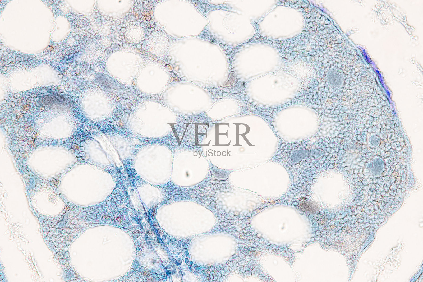 实验室显微镜下的骨人、弹性软骨人和红骨髓组织标本。照片摄影图片