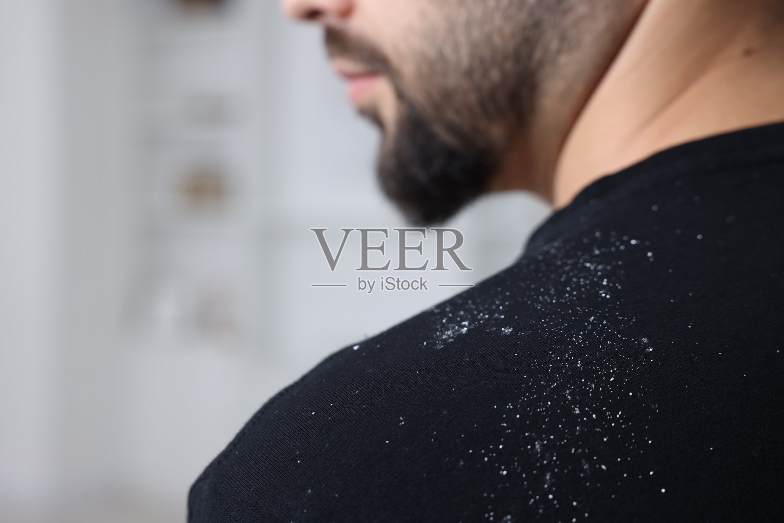 一个毛衣上有头皮屑的人在室内,特写。文本空间照片摄影图片