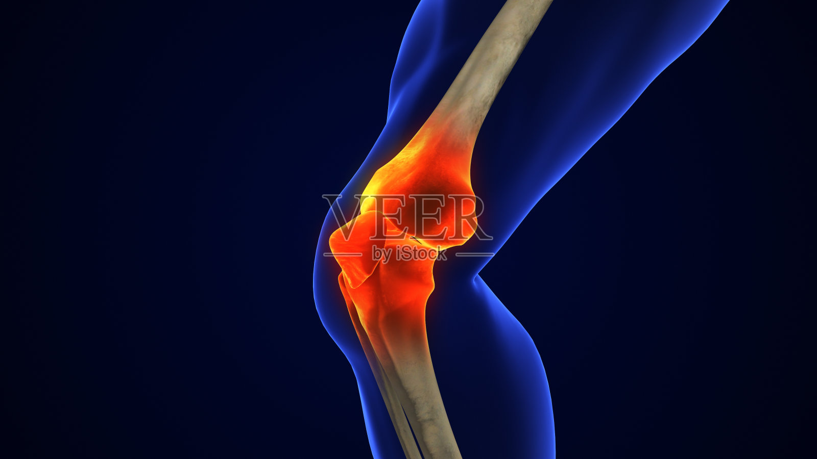 人体膝关节治疗,骨关节炎注射照片摄影图片