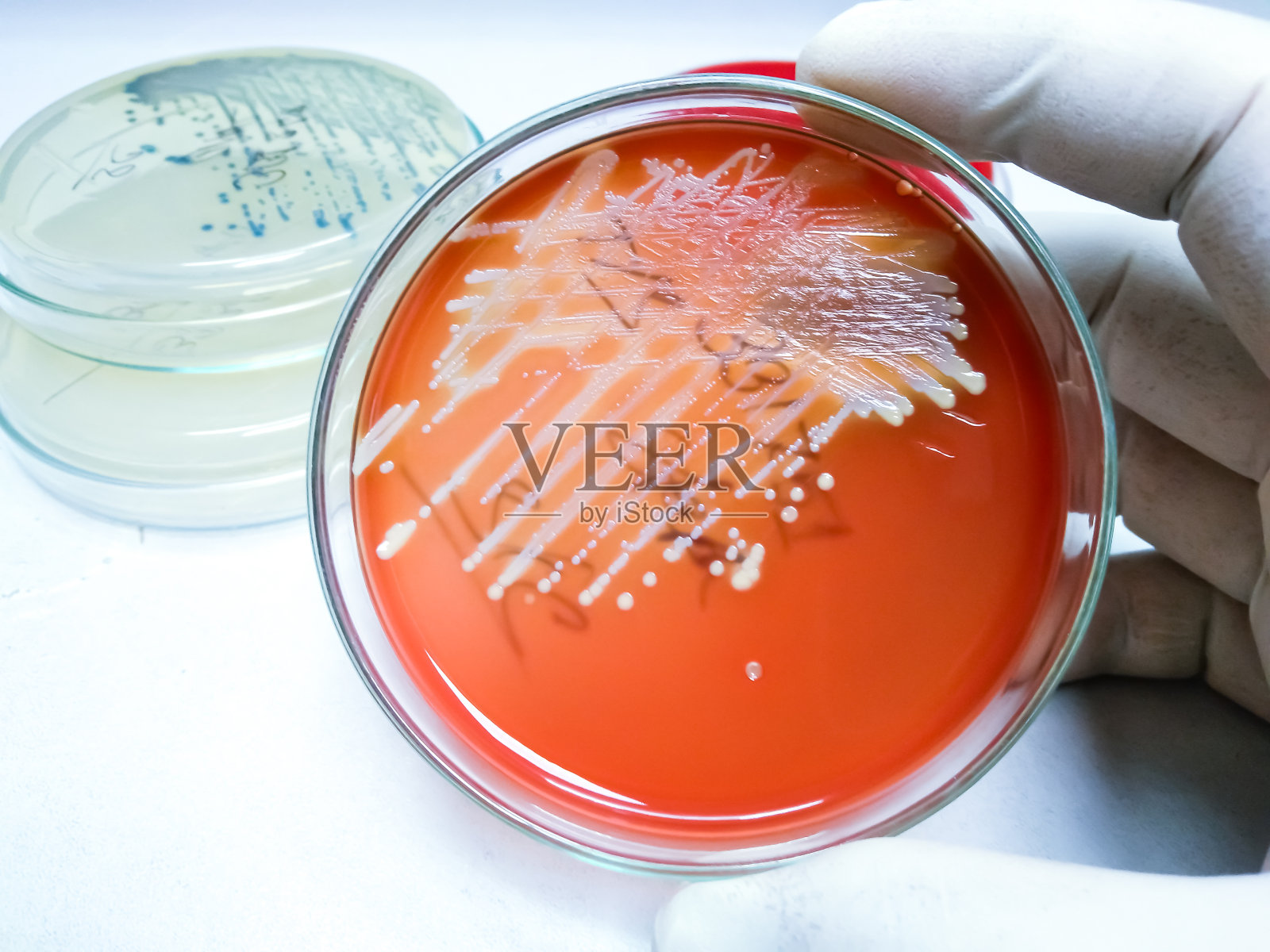 培养皿药敏试验。照片摄影图片