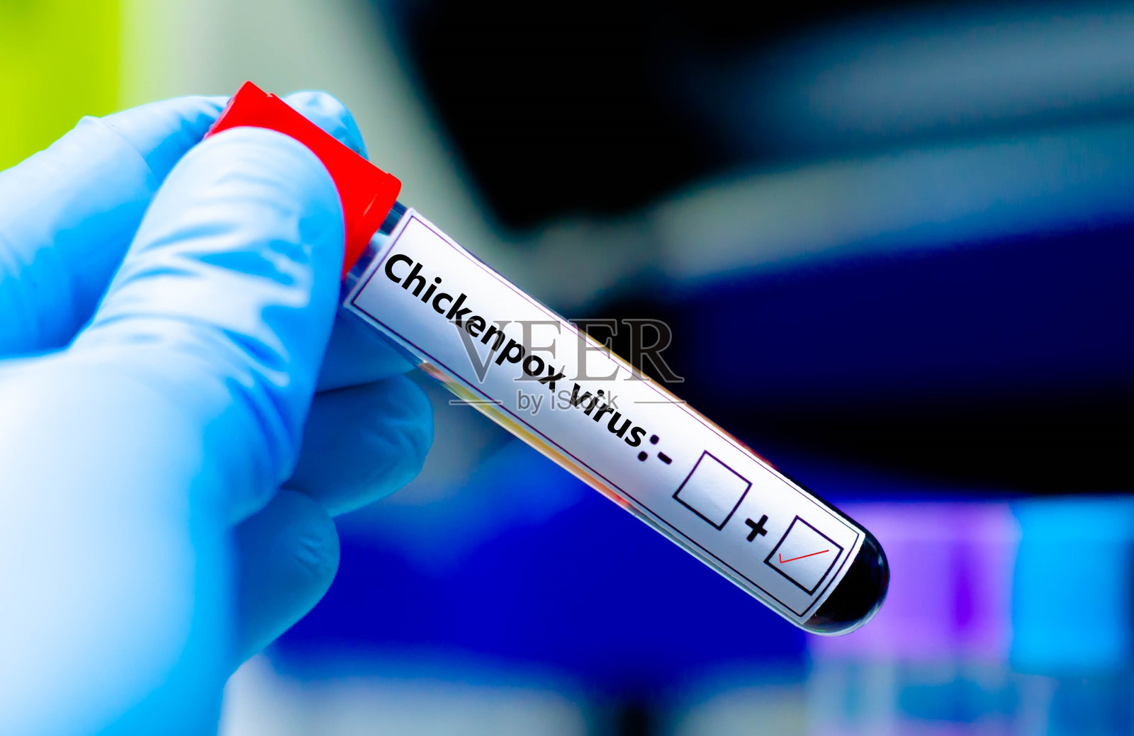 采血管照片摄影图片