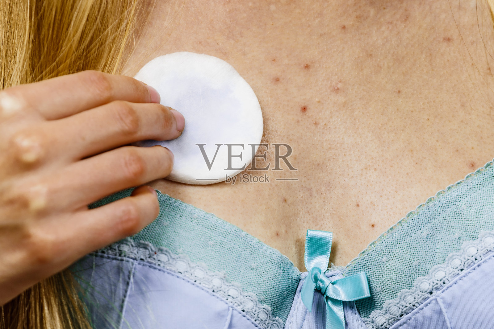 女士领口痘痘用滋补品清洁皮肤照片摄影图片