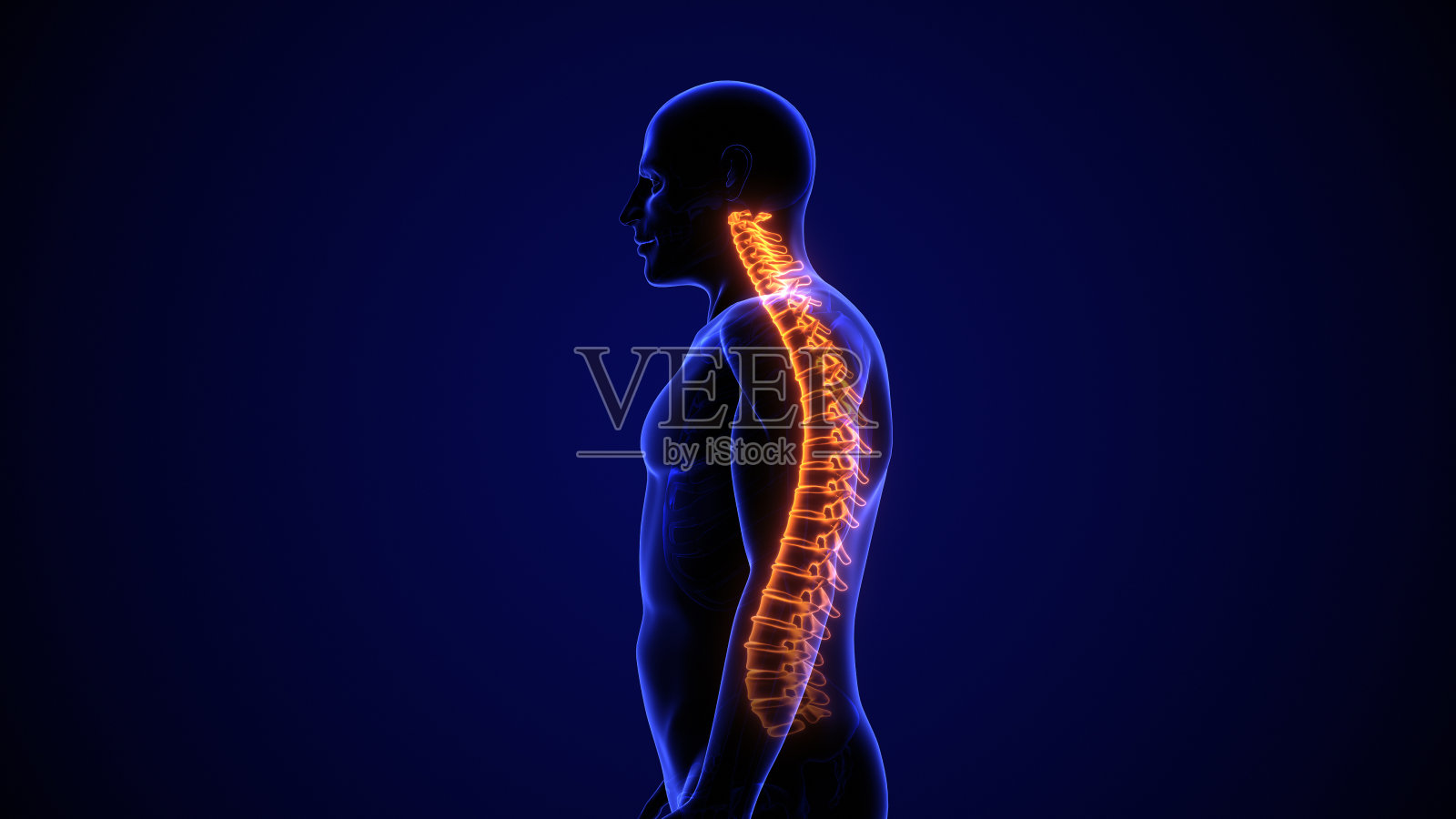 颈椎体-位功能障碍或体-位综合征照片摄影图片