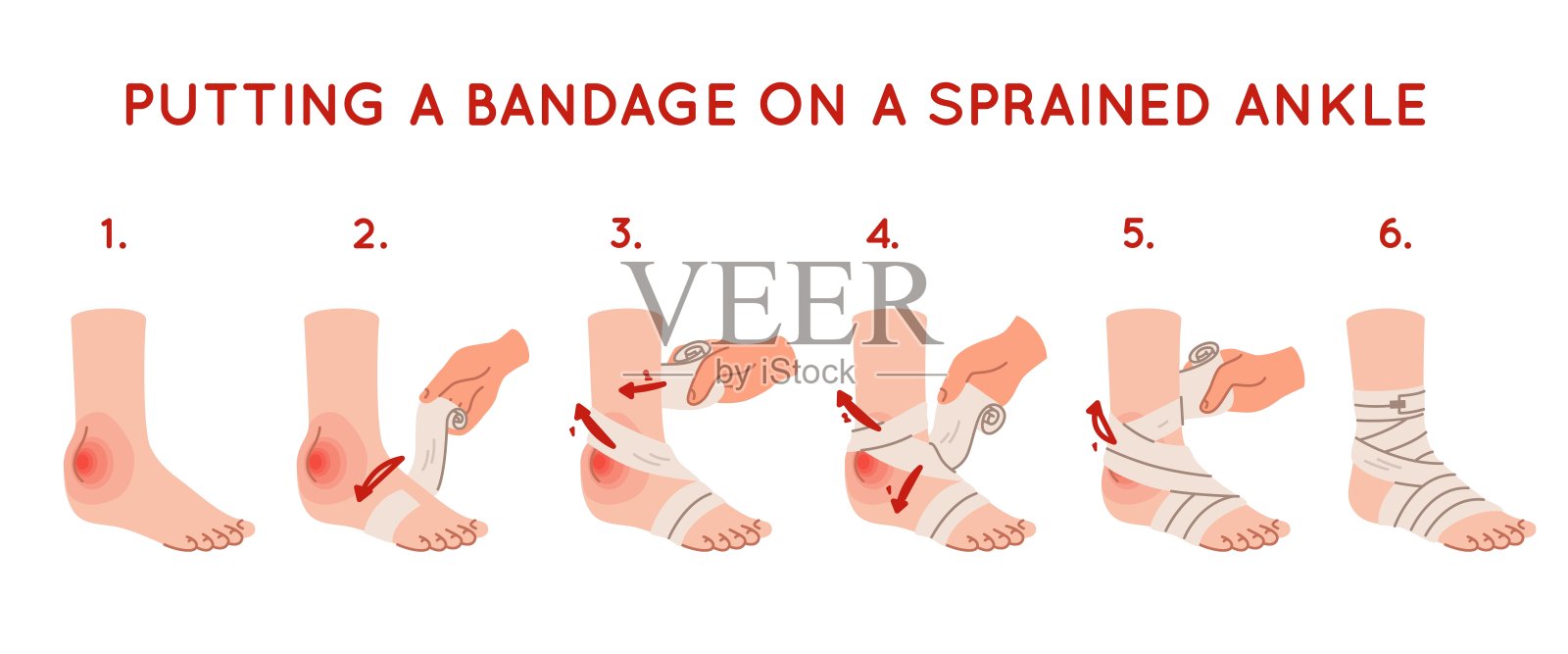 用弹力绷带包扎脚踝。脚受伤。软组织肿胀。医疗服务。急救。一步一步的说明。骨折。创伤治疗手册。最近的矢量信息图插画图片素材