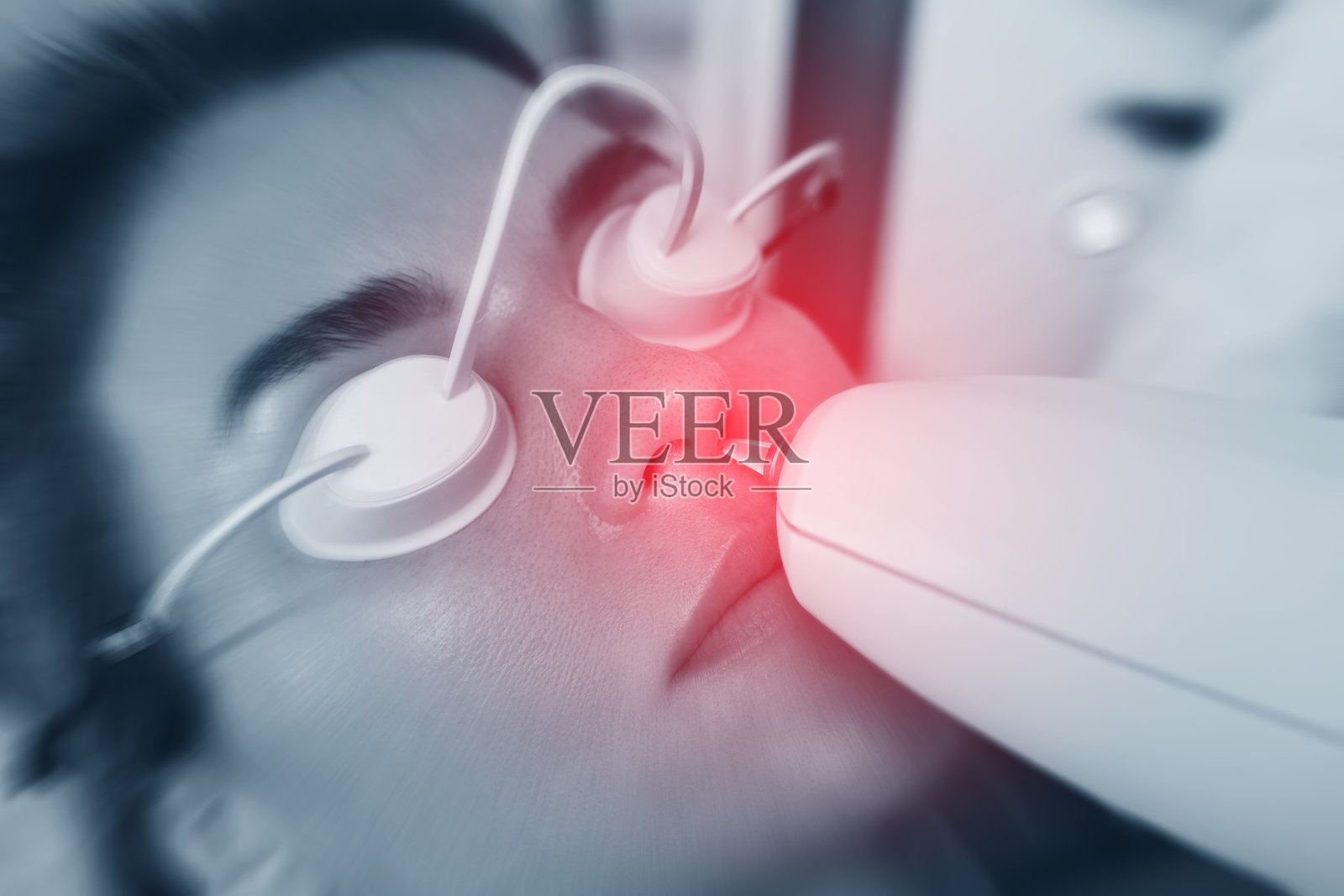 女性客户在IPL治疗期间在美容诊所照片摄影图片