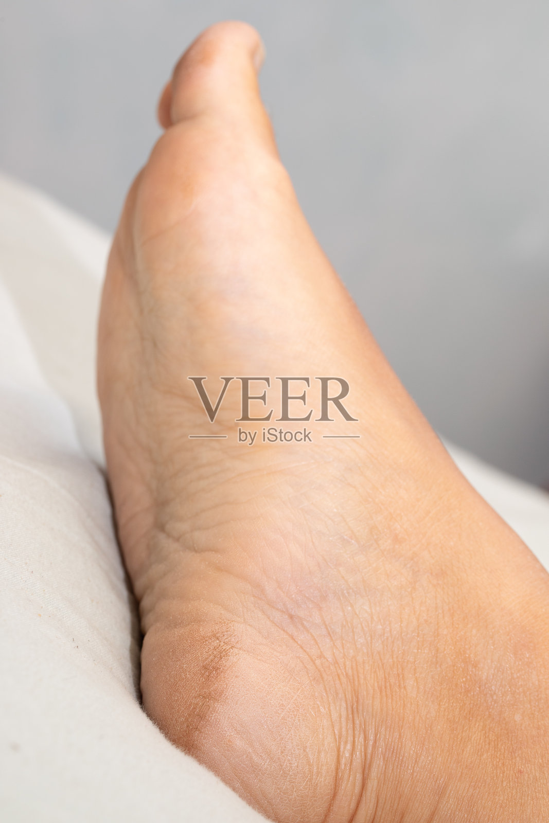 一名女子脚后跟皮肤干燥照片摄影图片