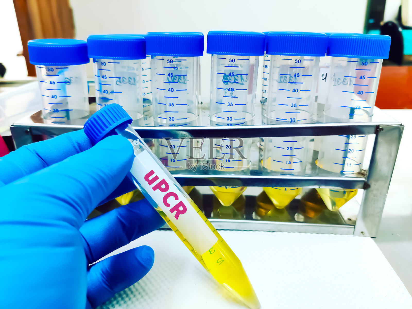 尿蛋白肌酐比率(UPCR)检测概念的生物样本。照片摄影图片