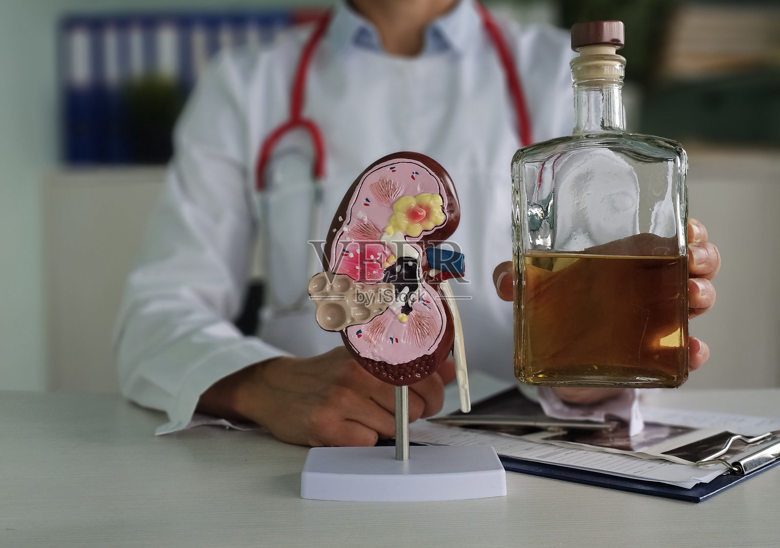 医生手持酒瓶和肾脏模型照片摄影图片