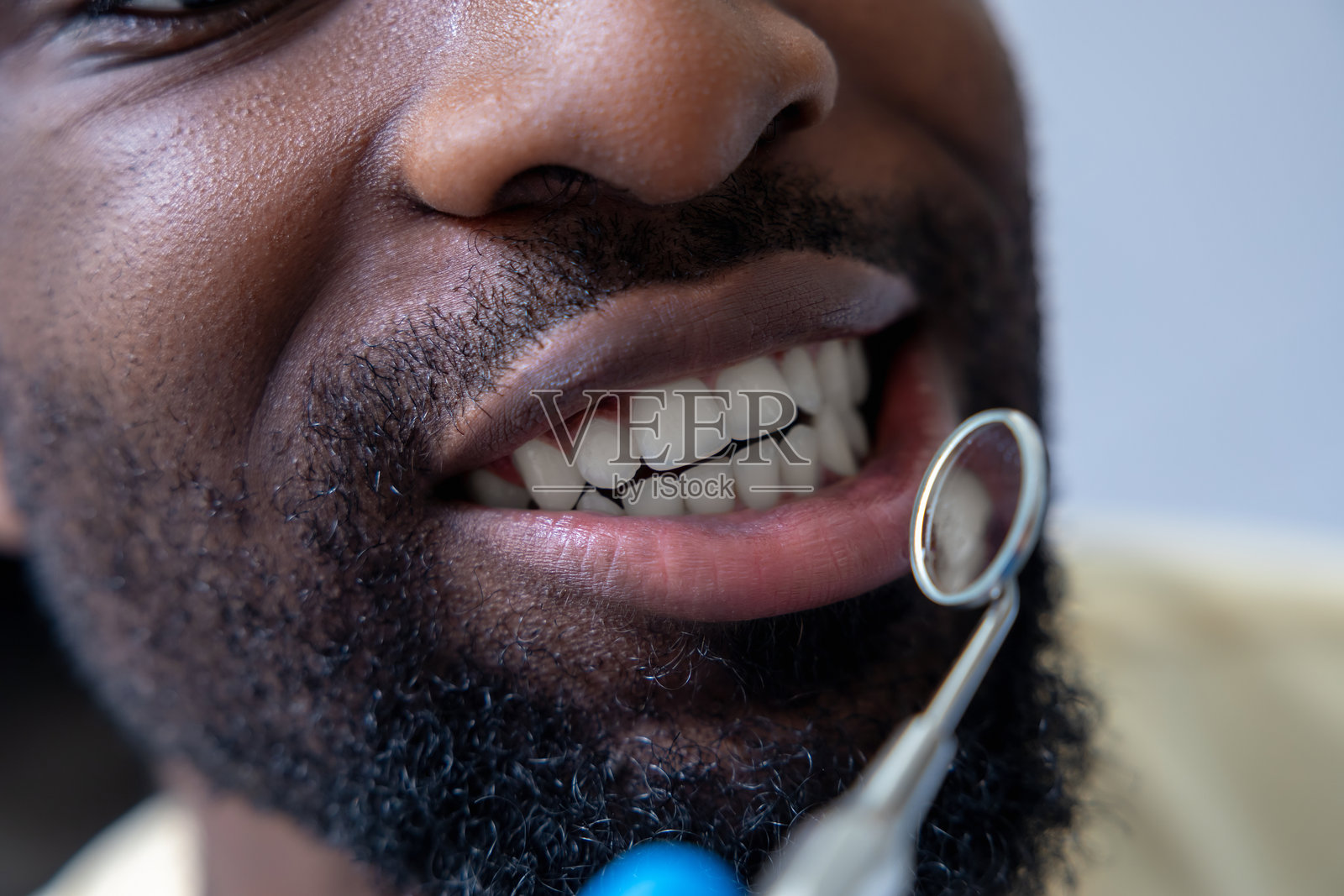 男牙医使用镜子检查患者的牙齿,在检查过程中提供必要的治疗。照片摄影图片