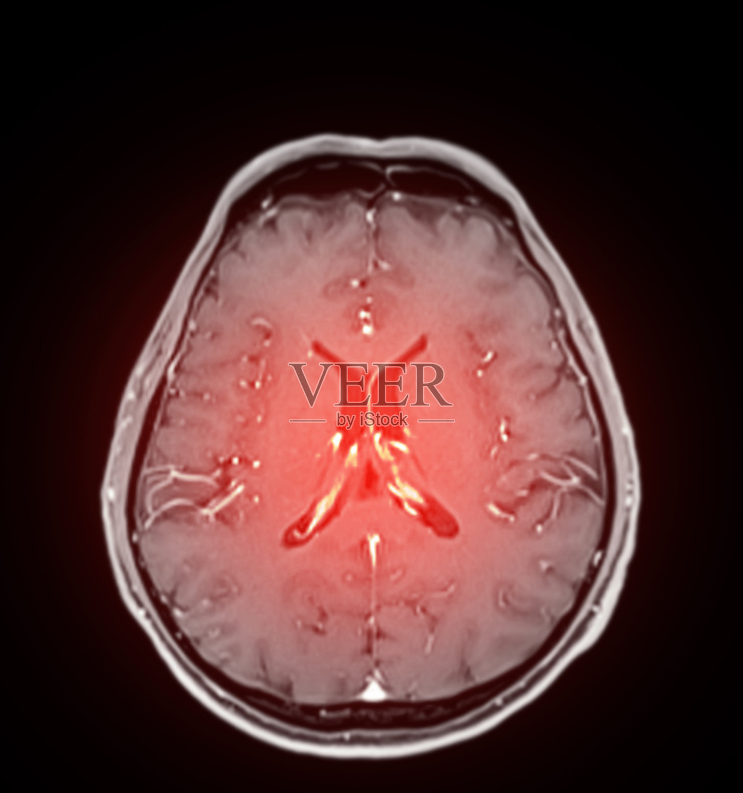 脑部MRI扫描,红色高亮区域可能表示关注的部位。适用于神经诊断、医学研究和教育内容。照片摄影图片