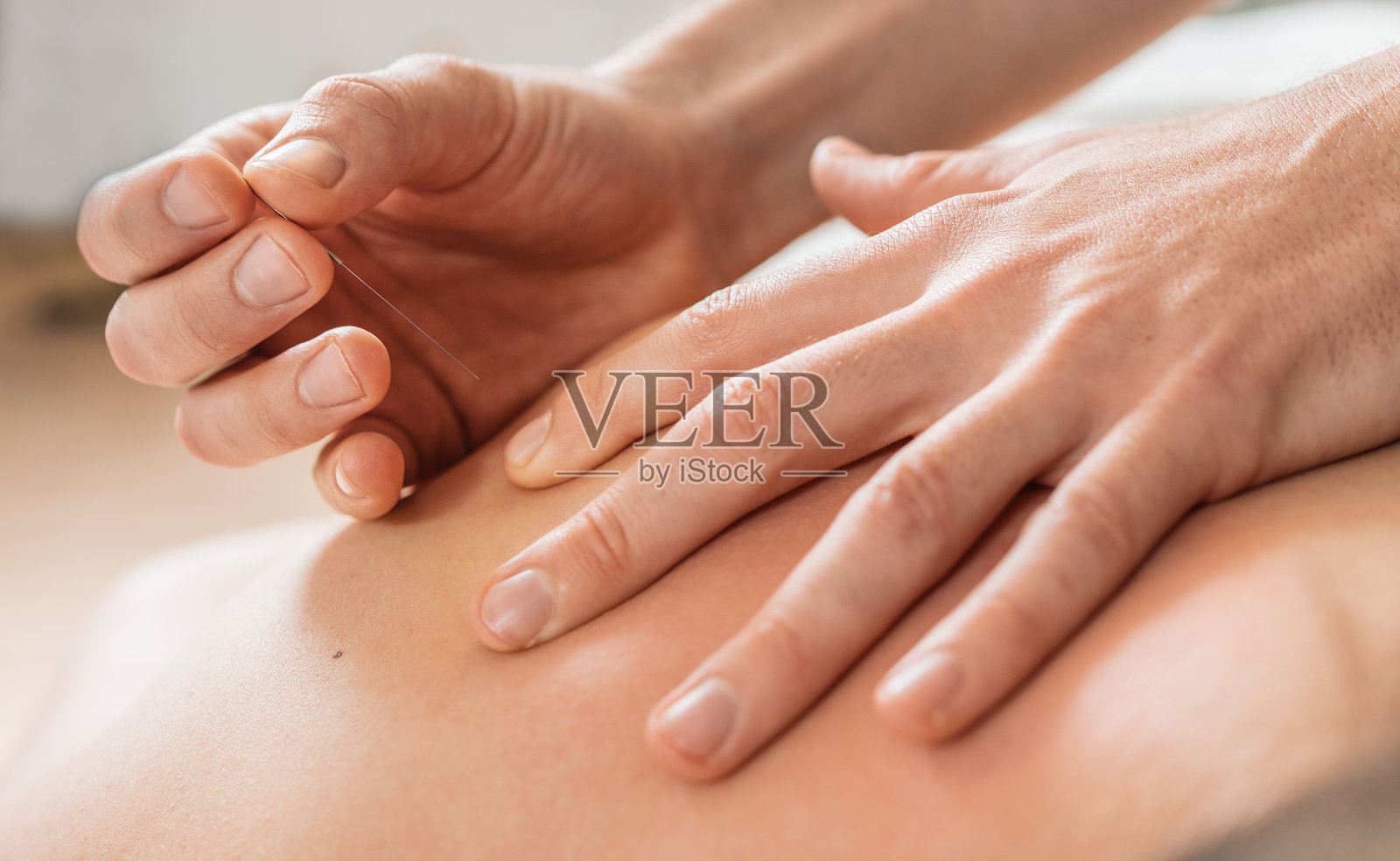 治疗师的手部特写,正在通过轻柔地将细针插入患者皮肤进行针灸治疗。图像突显了诊所中放松和替代医学的健康护理实践。照片摄影图片
