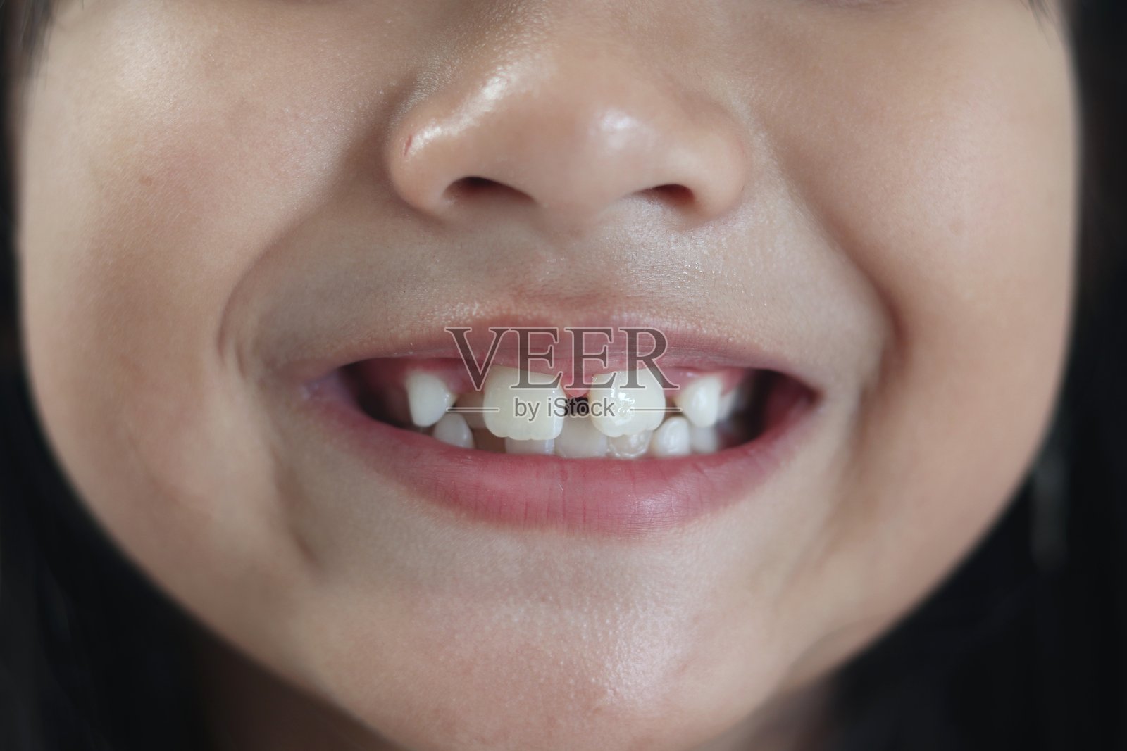 女孩展示牙齿的特写。牙齿健康概念。照片摄影图片