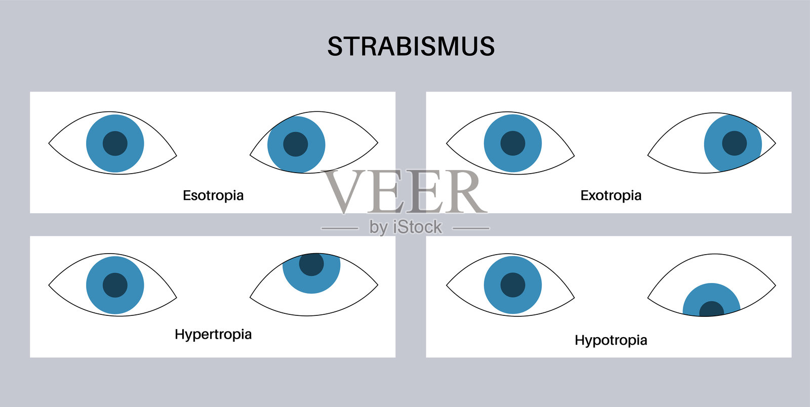 斜视眼病插画图片素材