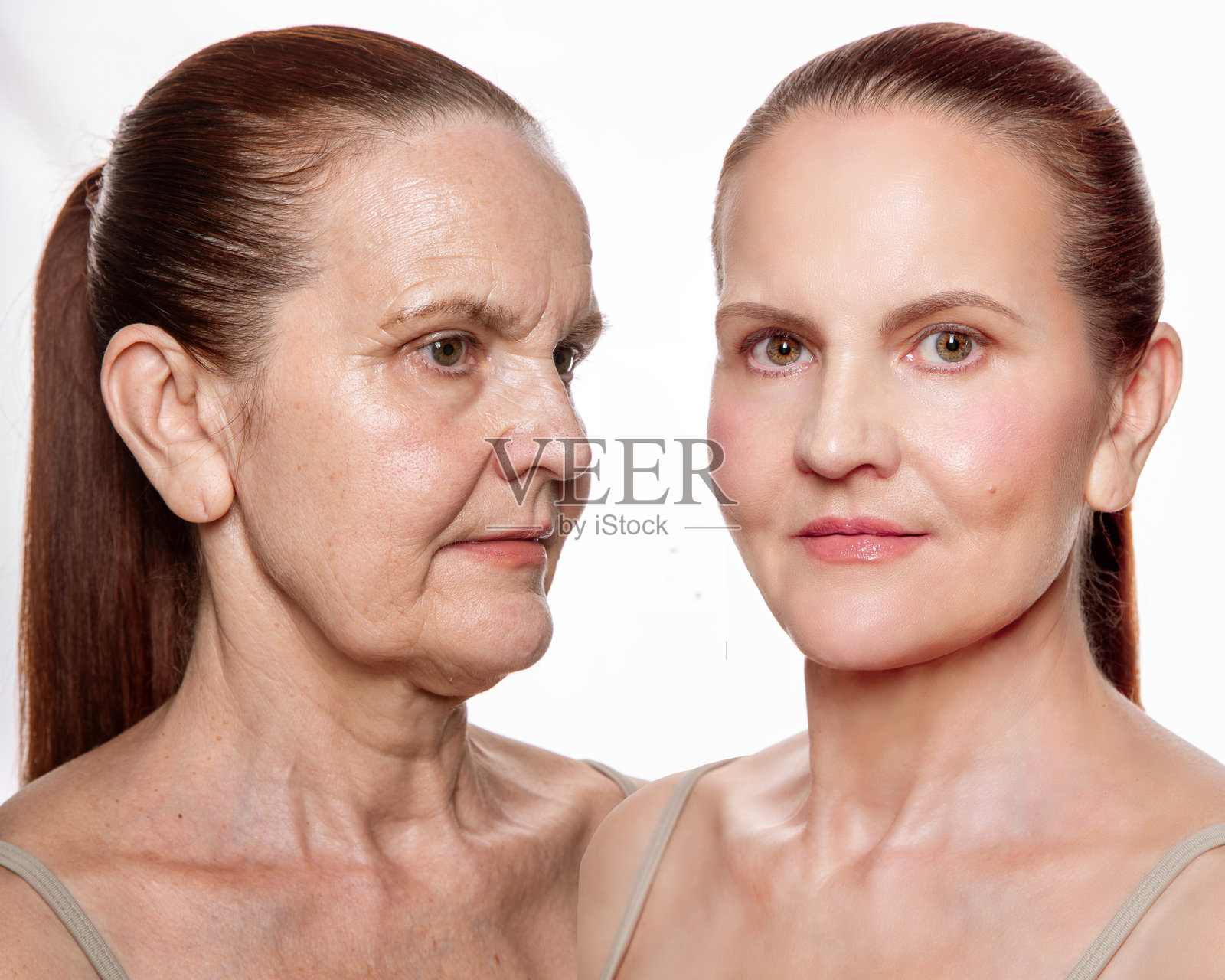 成年人的面部和颈部皮肤及肌肉的康复。护肤前后对比。白色背景下的特写。照片摄影图片